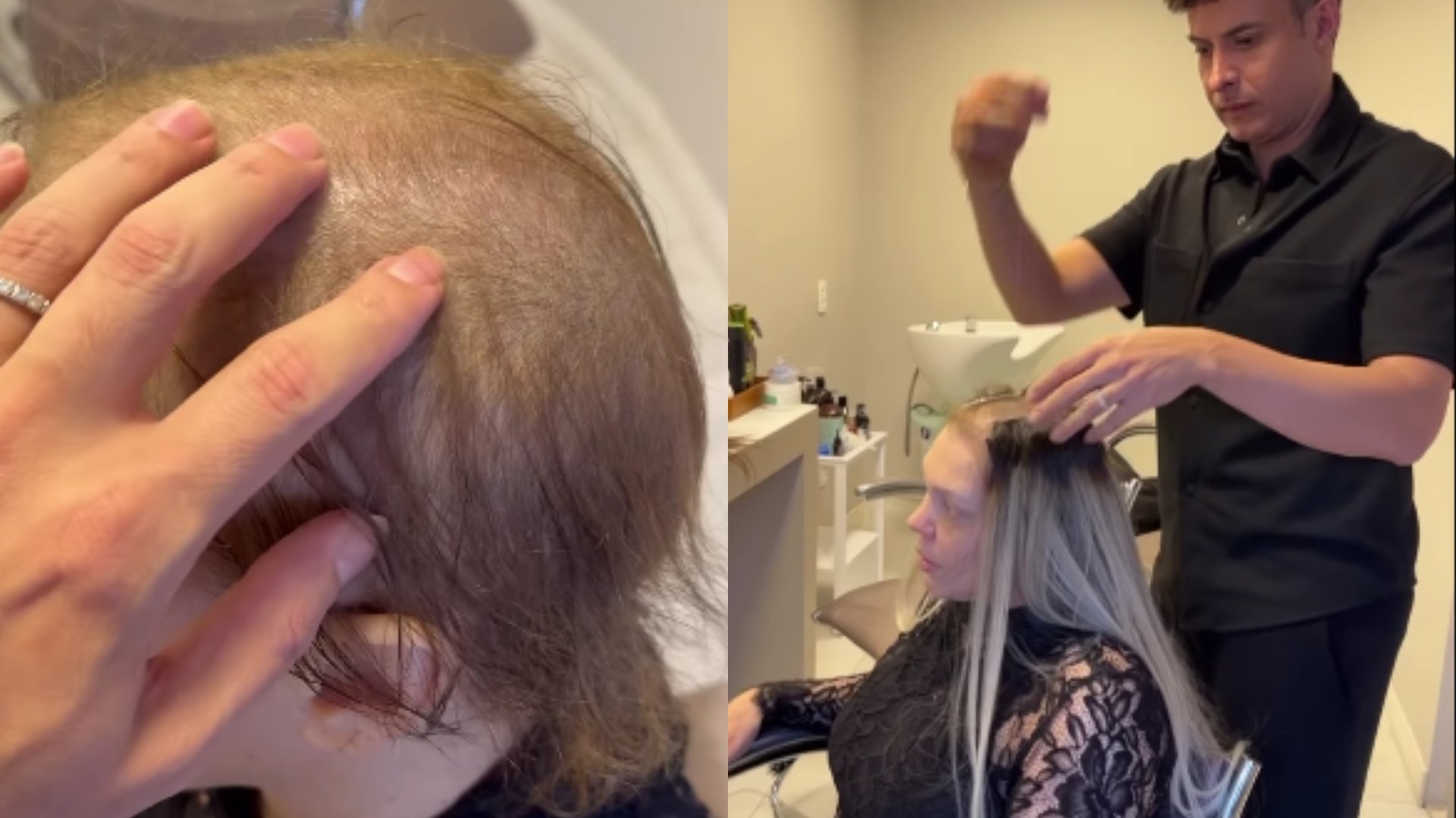 Após queda de cabelo, Simony faz transformação surpreendente no visual: “Cheguei até aqui”