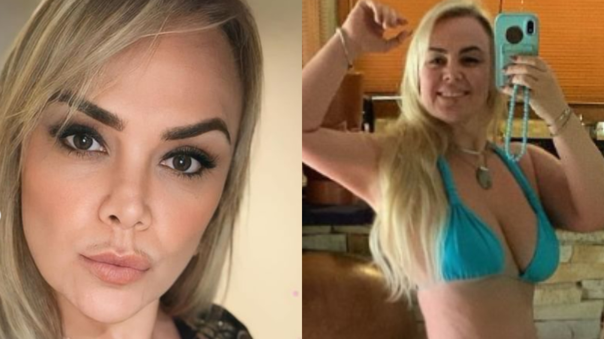 Aos 46 anos, ex-Paquita Ana Paula Almeida faz procedimento na região íntima