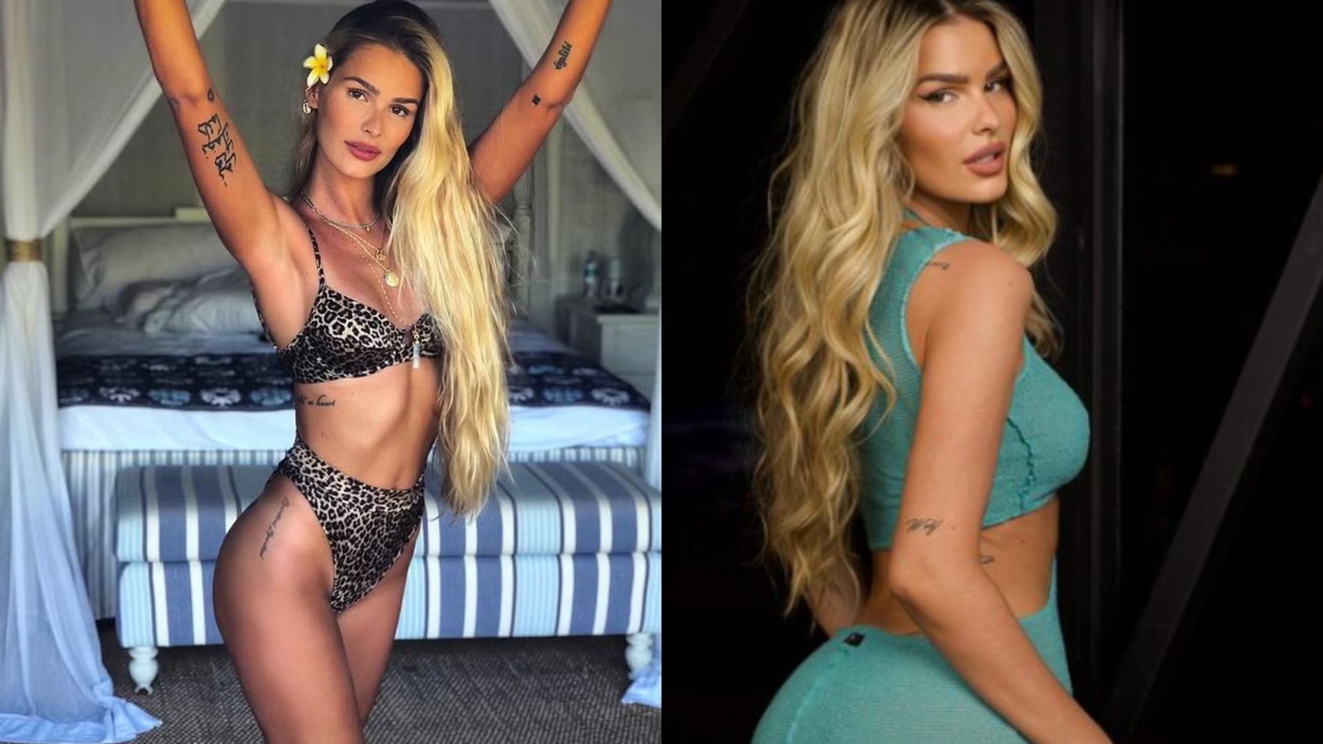 Antes e depois de Yasmin Brunet: Sister já fez procedimentos estéticos caríssimos