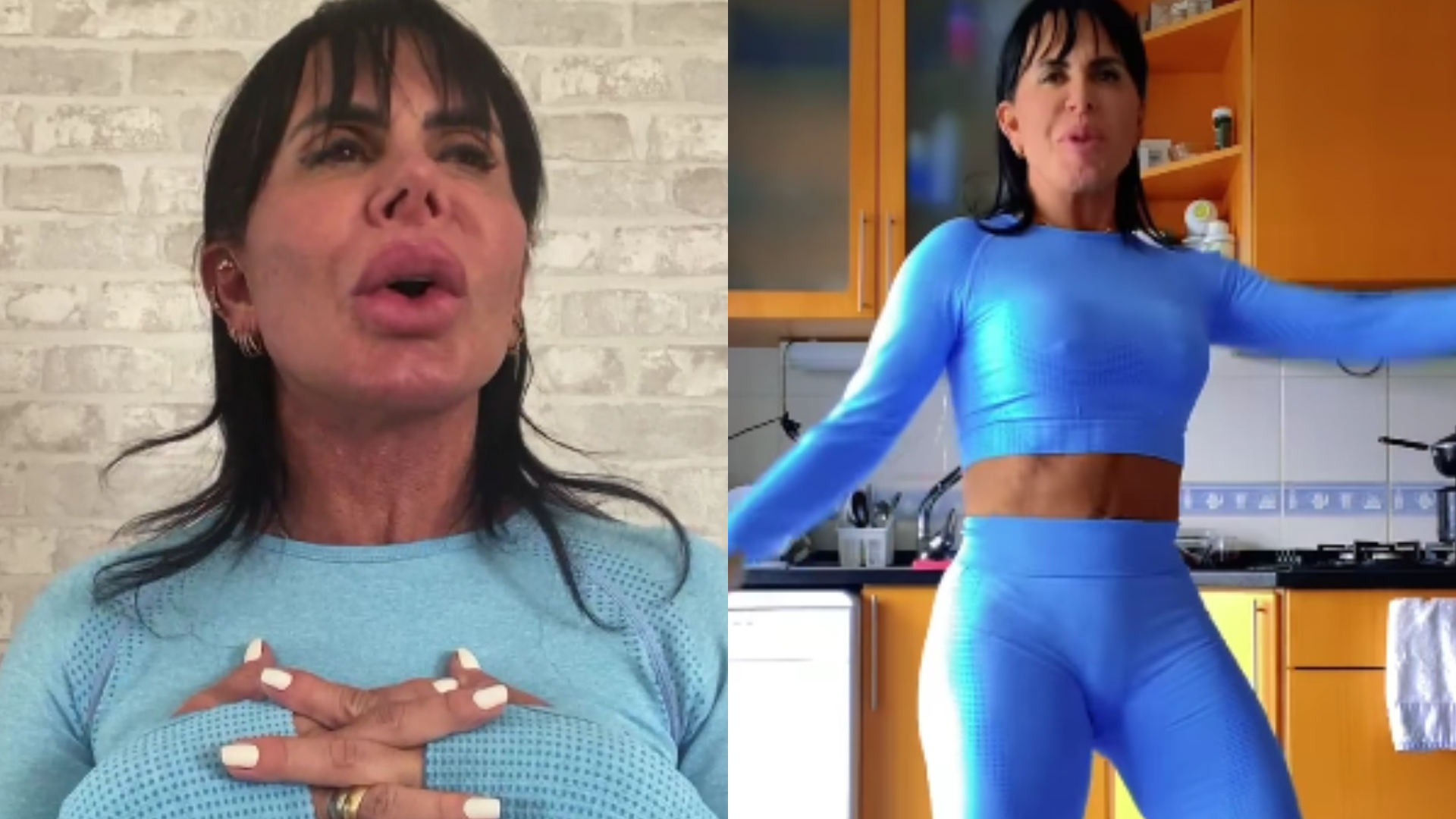 Gretchen rebate críticas sobre região íntima após procedimento: “Rechonchuda”