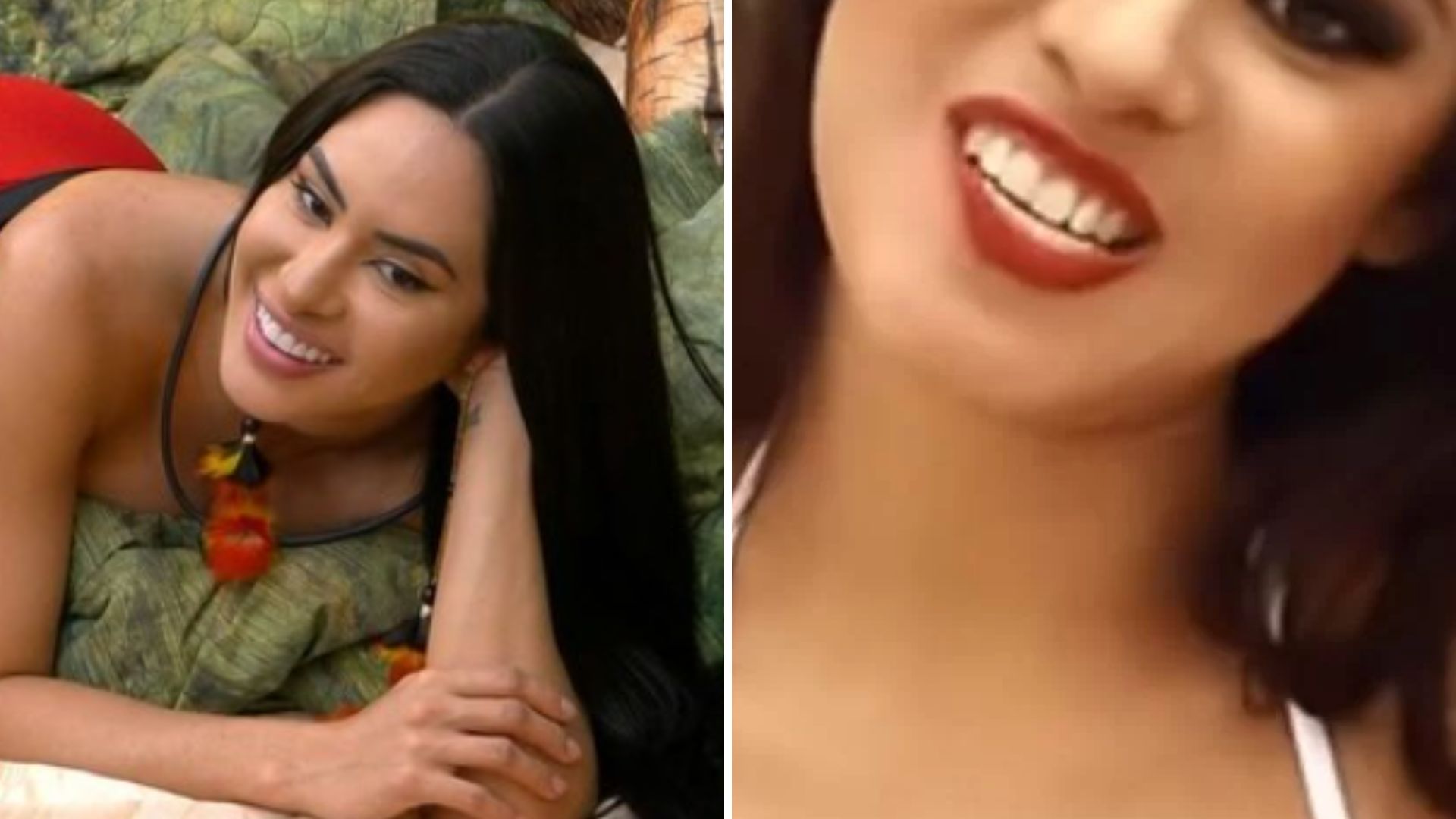 BBB24: Quais procedimentos Isabelle fez? Antes e depois da sister chocou fãs