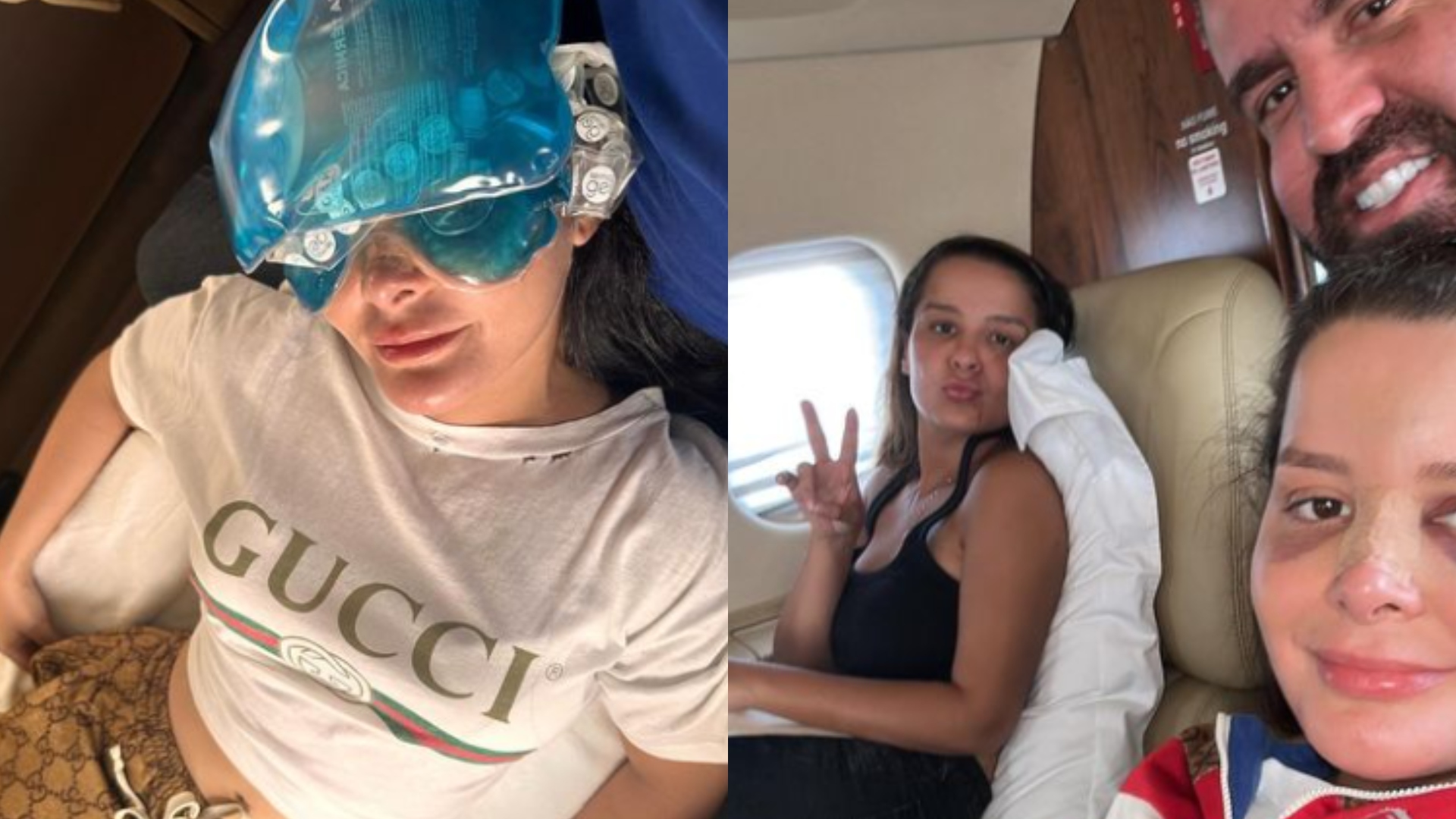 Como está Maraisa após acidente? Cantora exibe rosto machucado pela primeira vez
