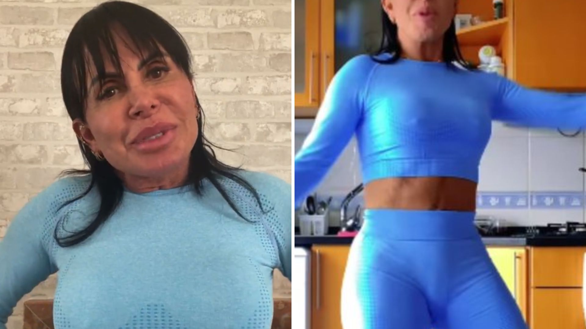 O que Gretchen fez na genitália? Região “preenchida” chamou atenção dos fãs