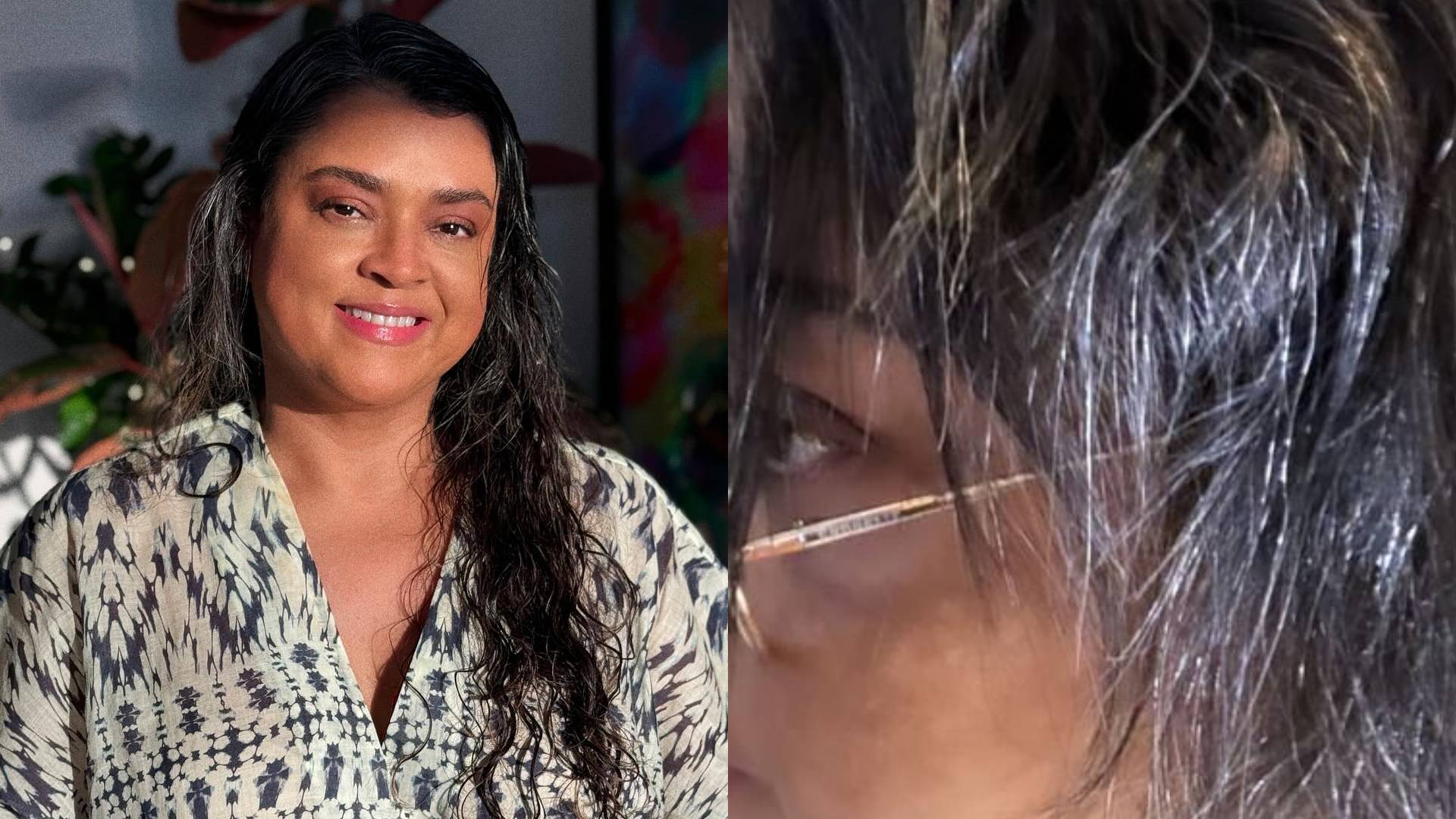 Preta Gil remove aplique e mostra cabelo real após quimio: “Caiu muito”