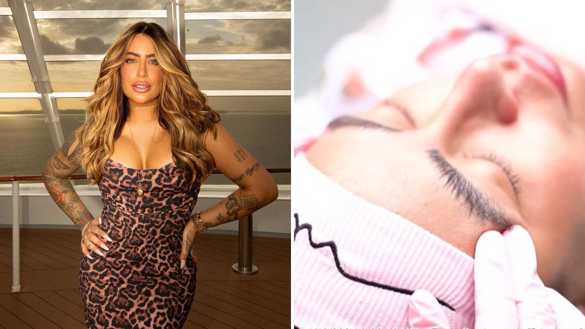 Rafaella Santos faz procedimento de R$ 12 mil nas sobrancelhas
