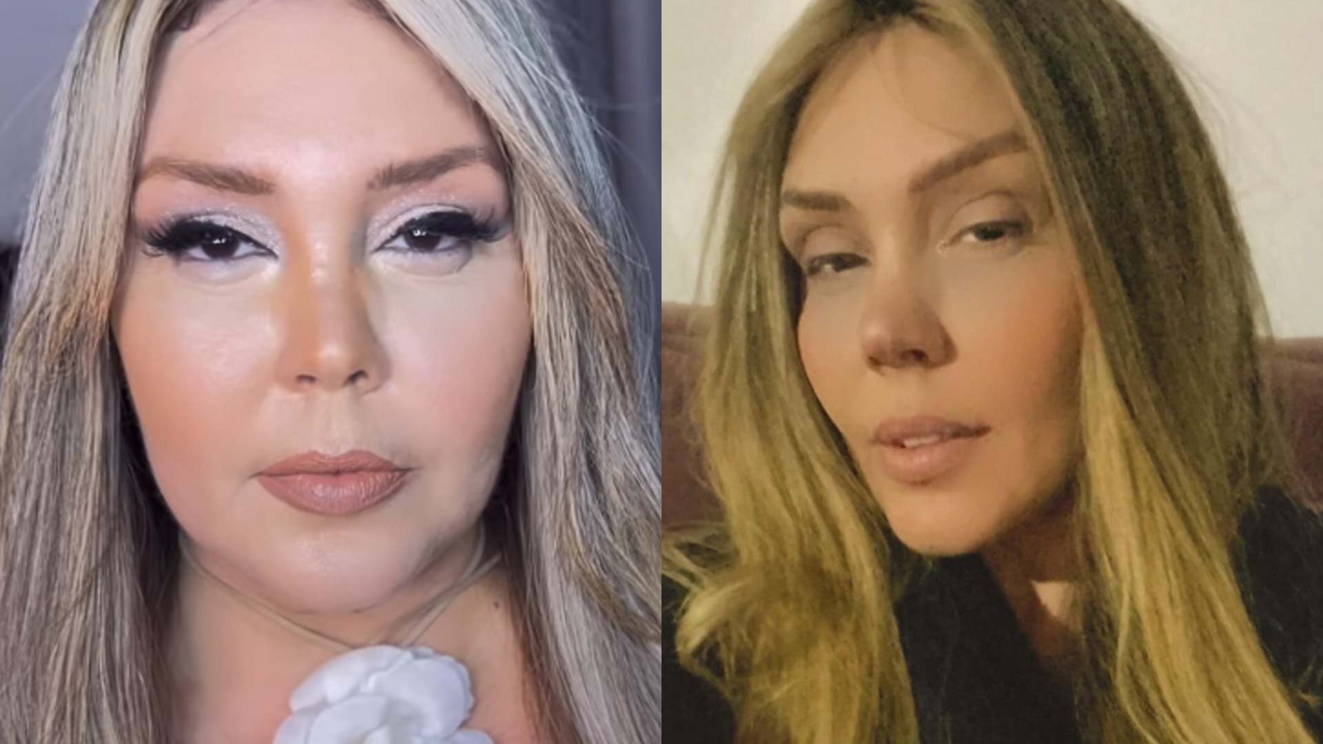 Simony rebate comentários sobre aparência e garante: “Não fiz harmonização”
