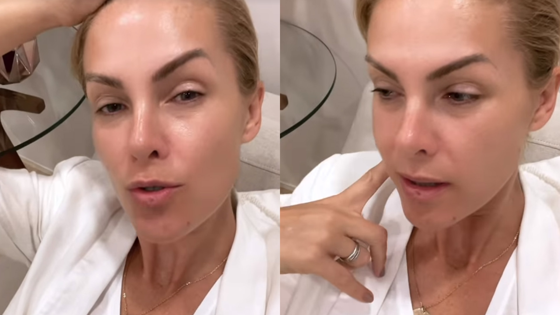 Exausta, Ana Hickmann desabafa sobre efeitos do stress no corpo: “Tá reagindo”