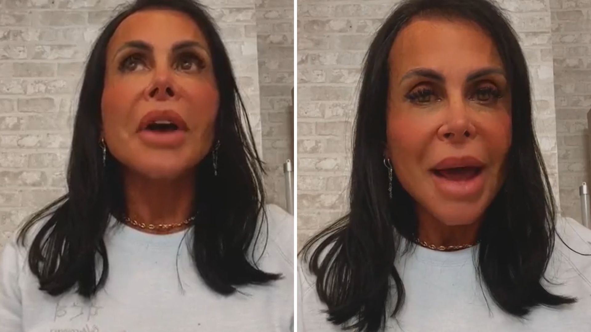 Antes da atual cirurgia, Gretchen cancelou operação no útero um dia antes: “Senti”