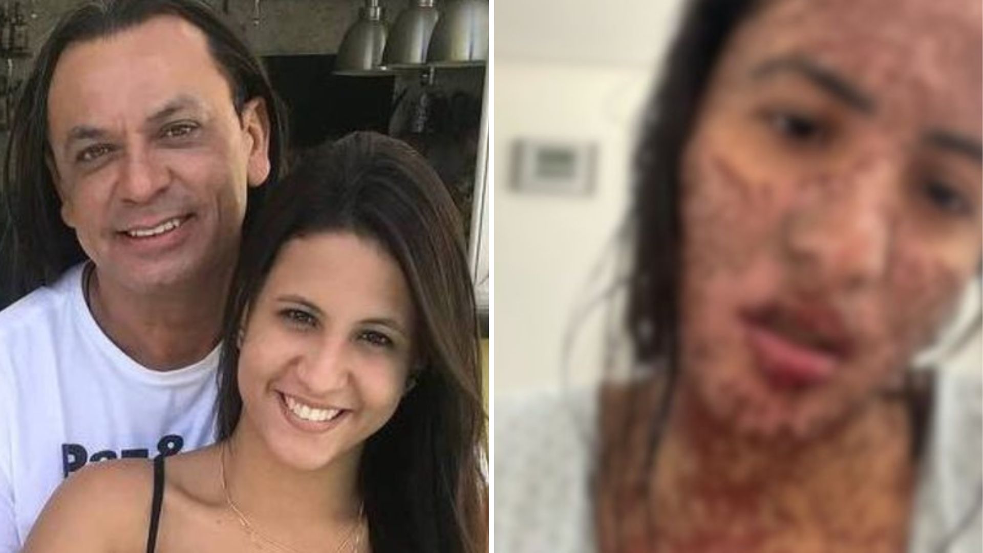 Antes do divórcio, mulher de Frank Aguiar teve doença rara: “Achei que ia morrer”