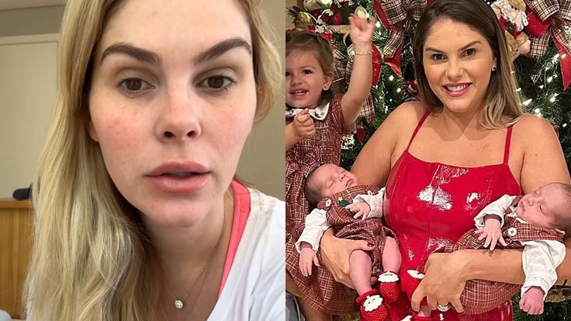 Bárbara Evans detalha cirurgia doloroza que fez após gravidez: “Sofri muito”