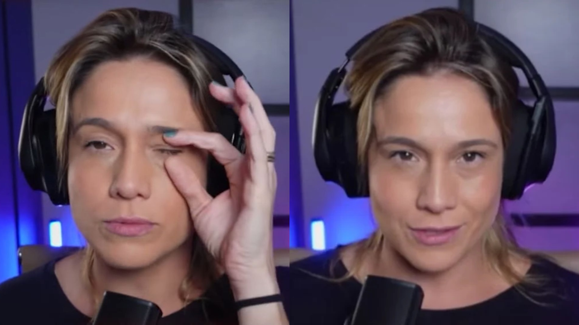 Paralisia facial: quais são as causas da condição que afeta Fernanda Gentil?