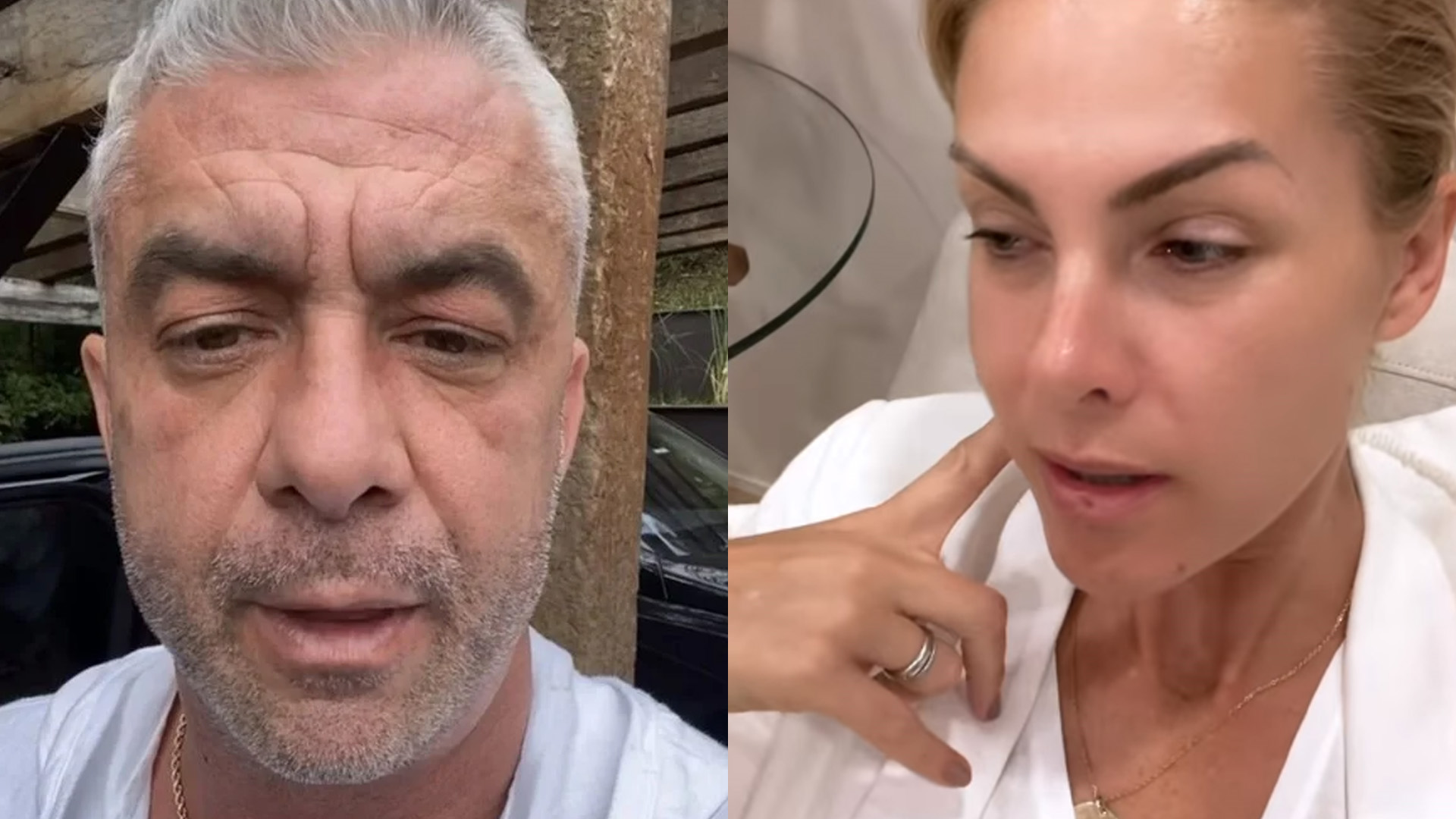 Ex acusa Ana Hickmann de tirar plano de saúde enquanto tratava contra câncer