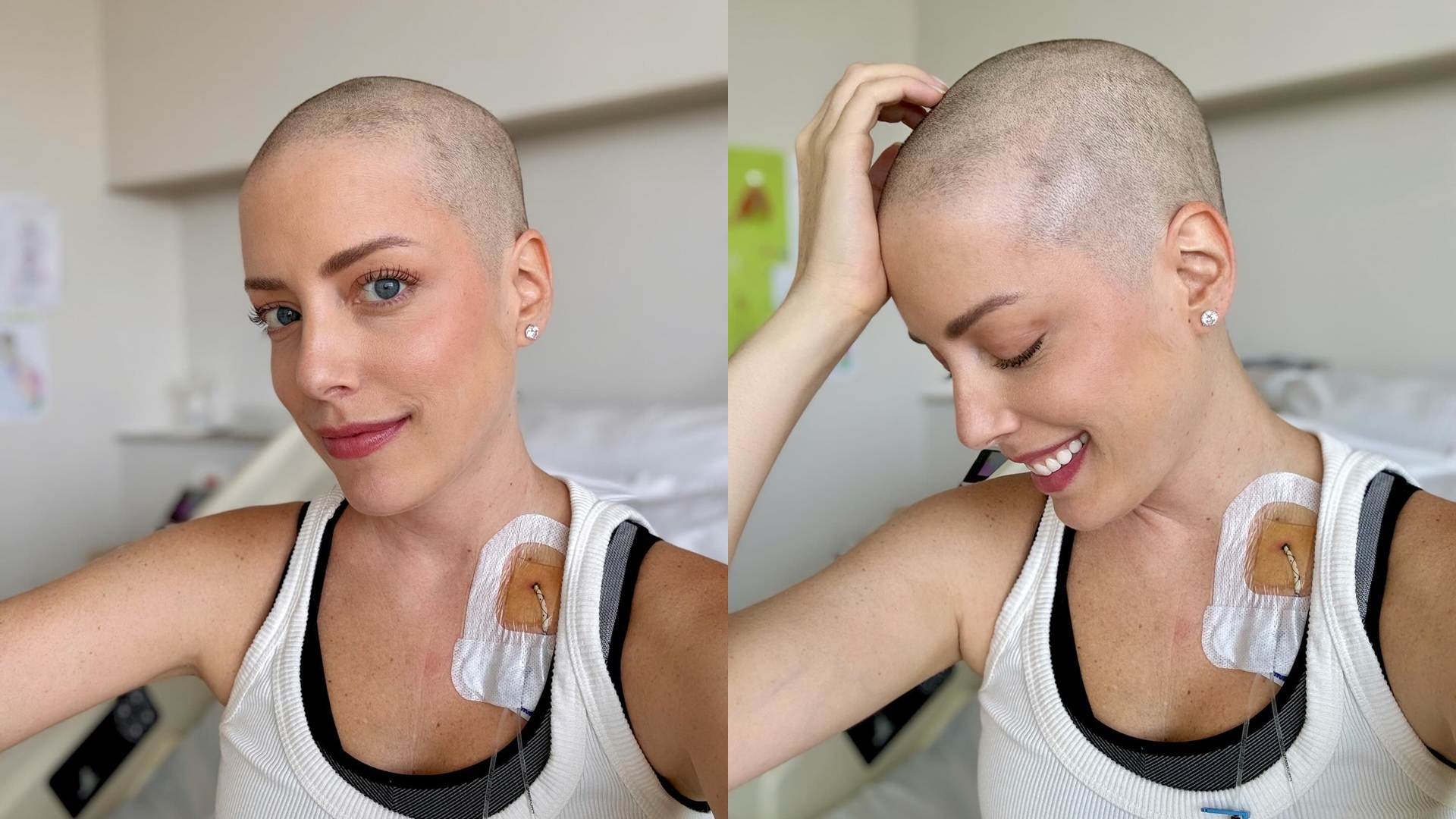 Fabiana Justus raspa o cabelo e desabafa em luta contra câncer: “Minha cura”