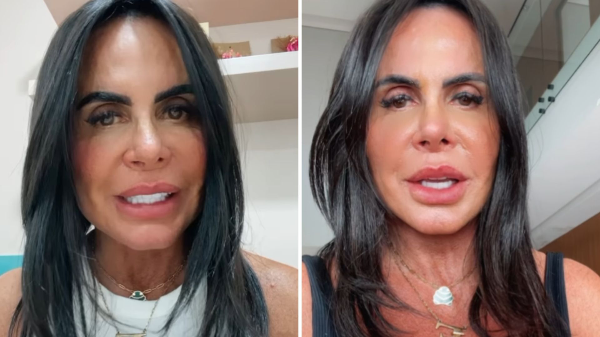 Gretchen comemora novo rosto após harmonização facial: “Delicado e leve”