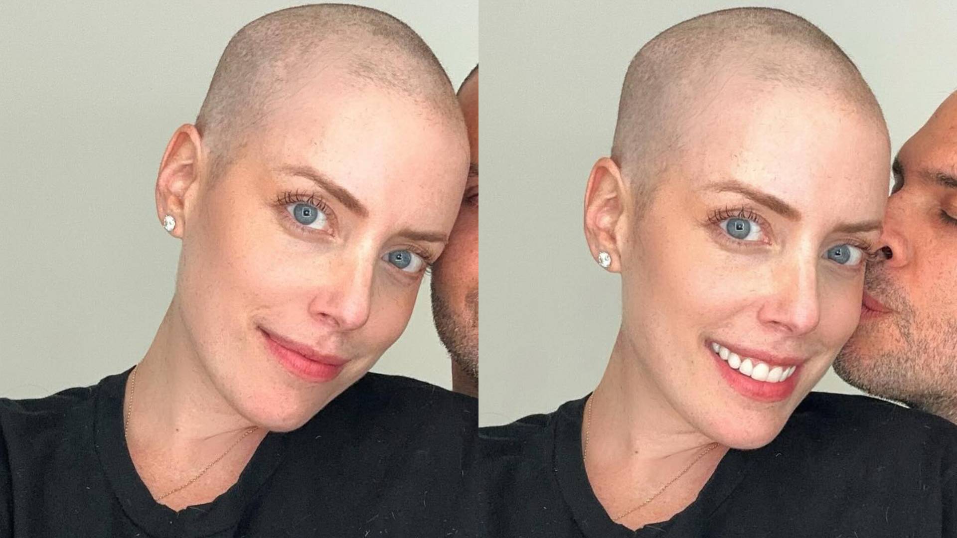 Marido de Fabiana Justus raspa a cabeça e causa comoção: “Te amo demais”