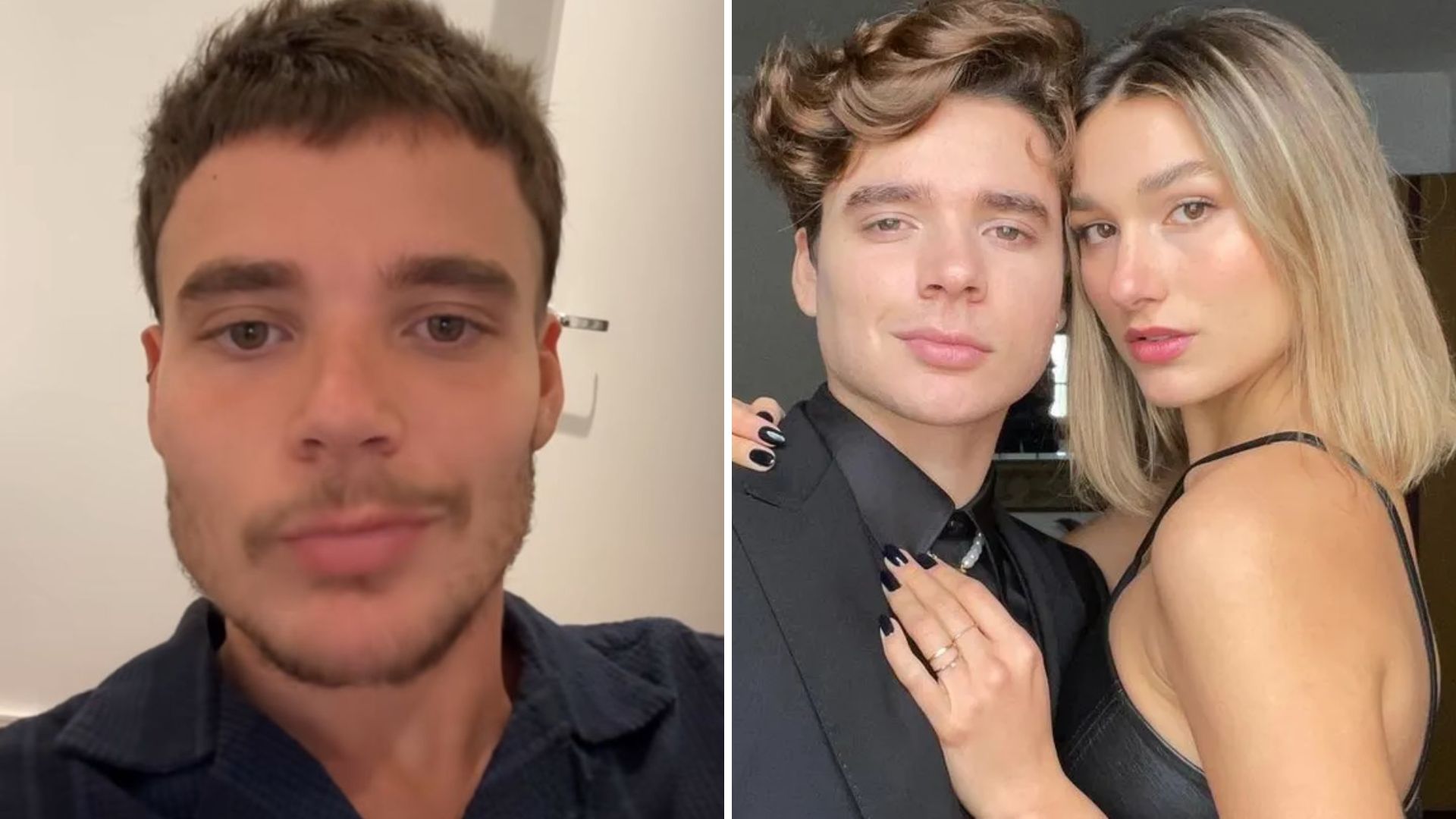 Harmonização? Saiba o segredo do marido de Sasha Meneghel para mudar o rosto
