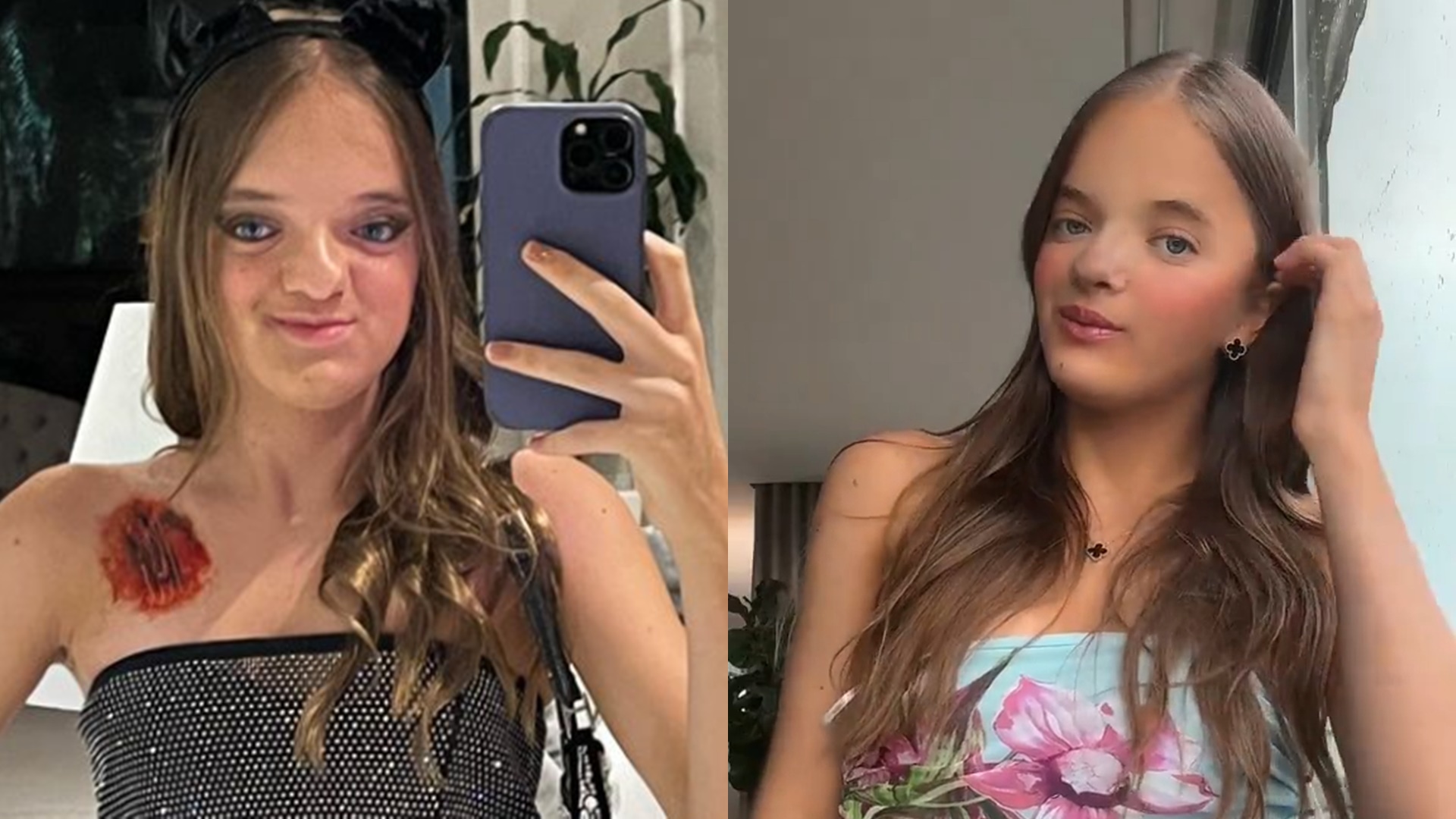 Rafaella Justus surpreende ao exibir resultado de rinoplastia: “Outra pessoa”