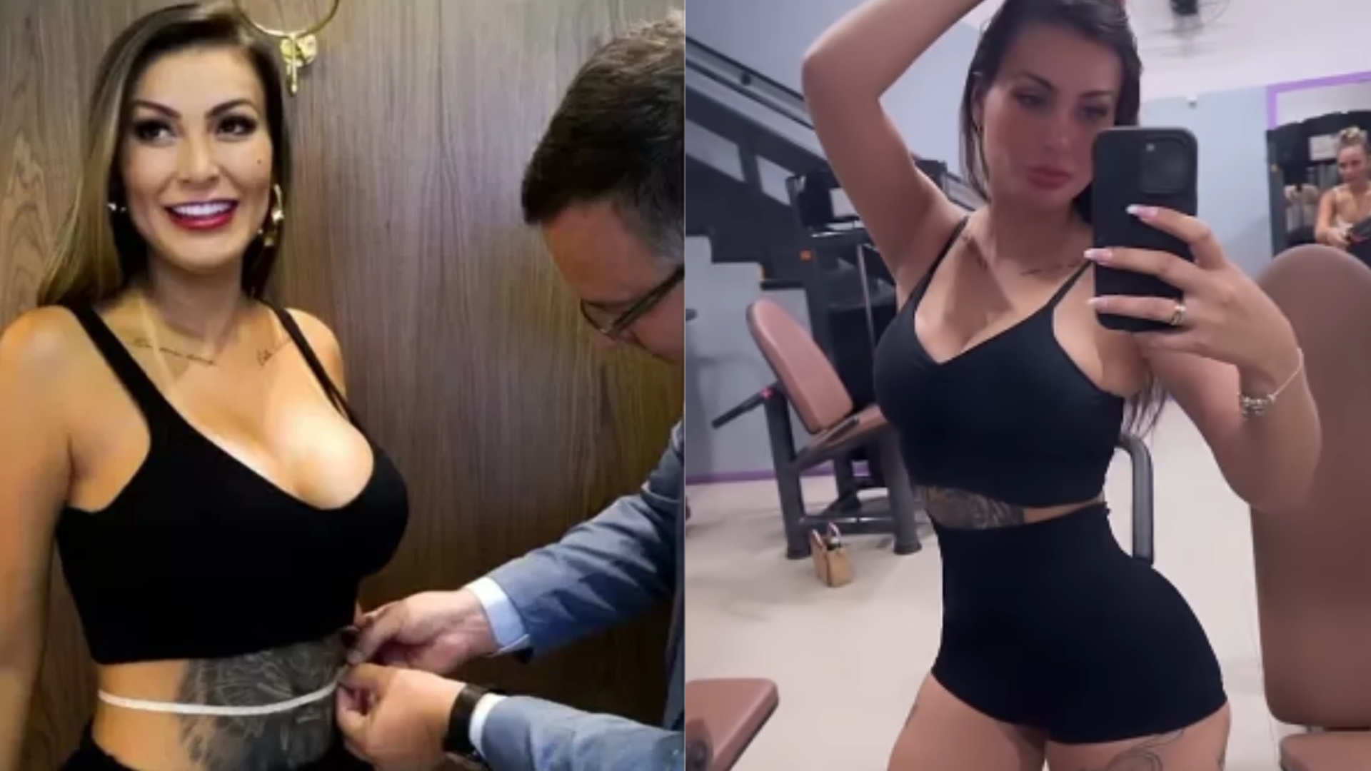 Andressa Urach fará cirurgia para retirar quatro costelas: “Cintura ainda mais fina”