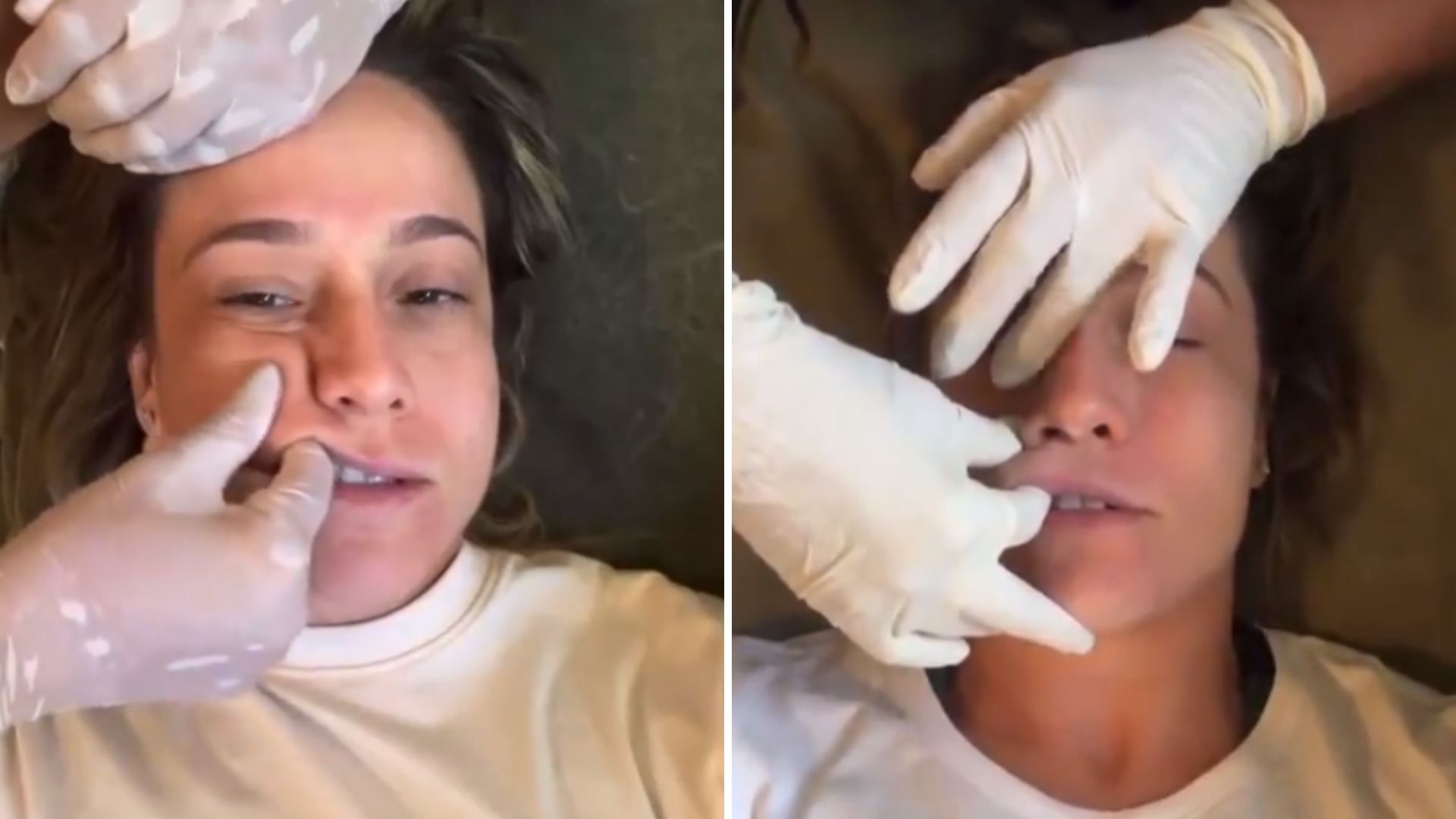 Fernanda Gentil sofre durante tratamento da Paralisia de Bell: “Dói pra cac*te”