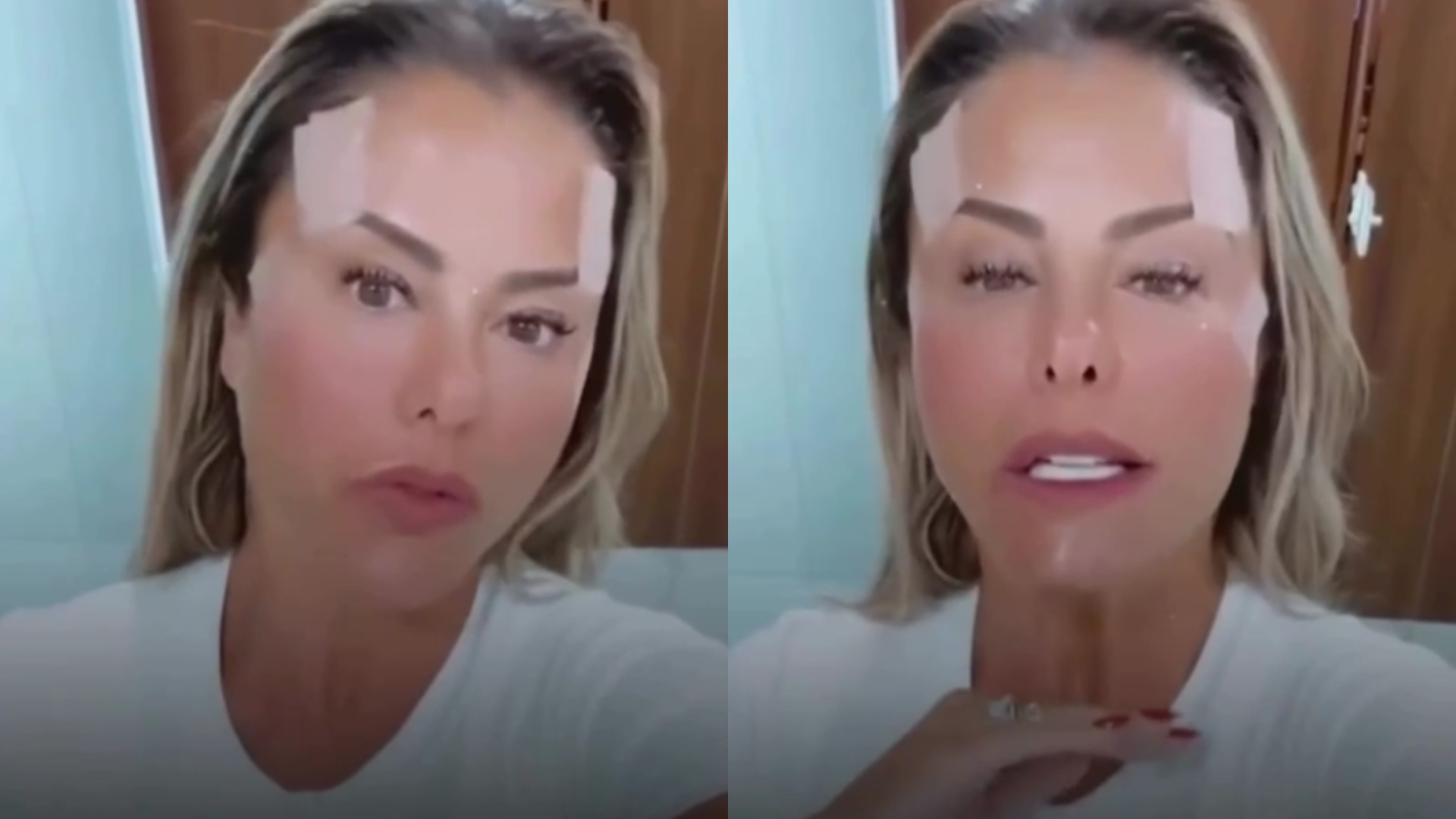 Médica faz alerta após Poliana Rocha fazer ‘cirurgia’ no rosto: “Essencial esclarecer”