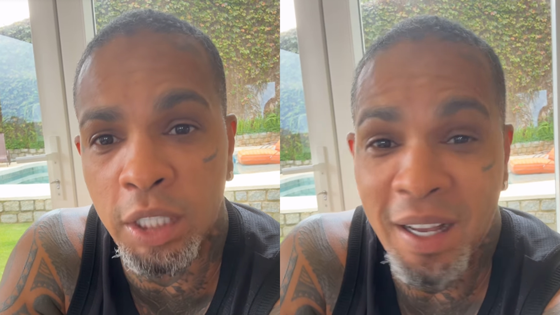 Rodriguinho conta verdade sobre procedimentos estéticos após o BBB 24: “Na cara”