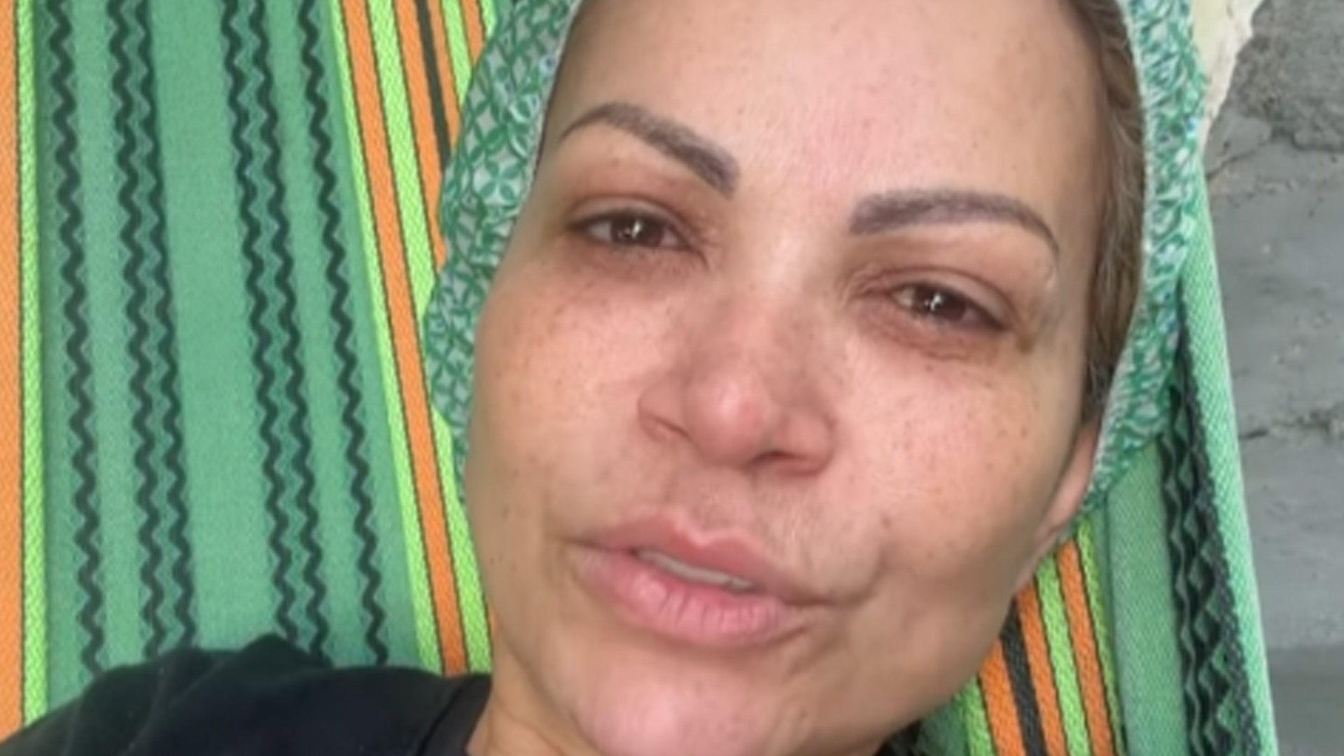 Solange Almeida passa por cirurgia às pressas e cancela agenda: “Repouso”