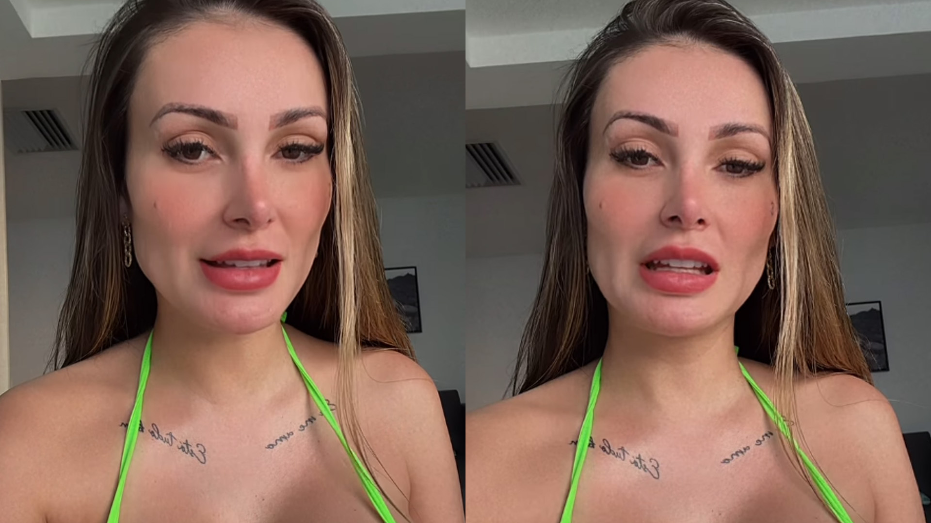 Andressa Urach mostra como era antes da fama e choca: “É cirurgia”