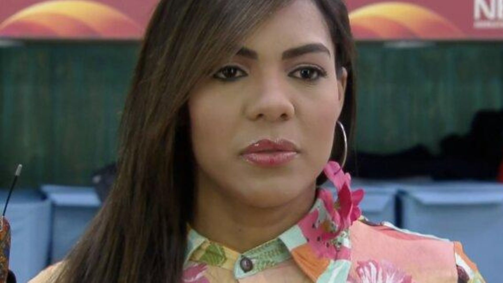 Ex-Fazenda Tays Reis choca com antes e depois de rinoplastia: “Ficou perfeita”
