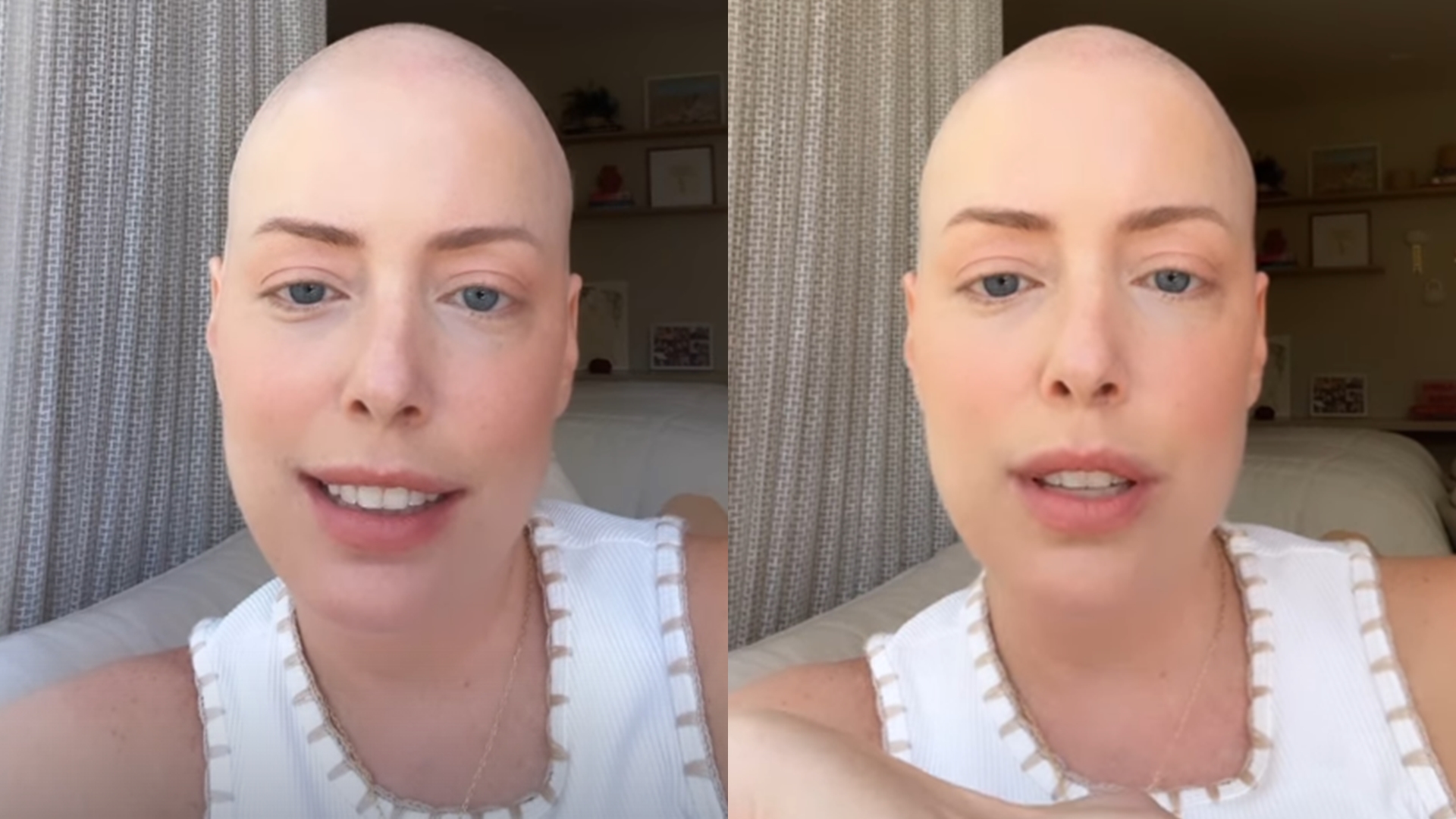 Fabiana Justus exalta o SUS após transplante de medula: “Todos têm esse direito”