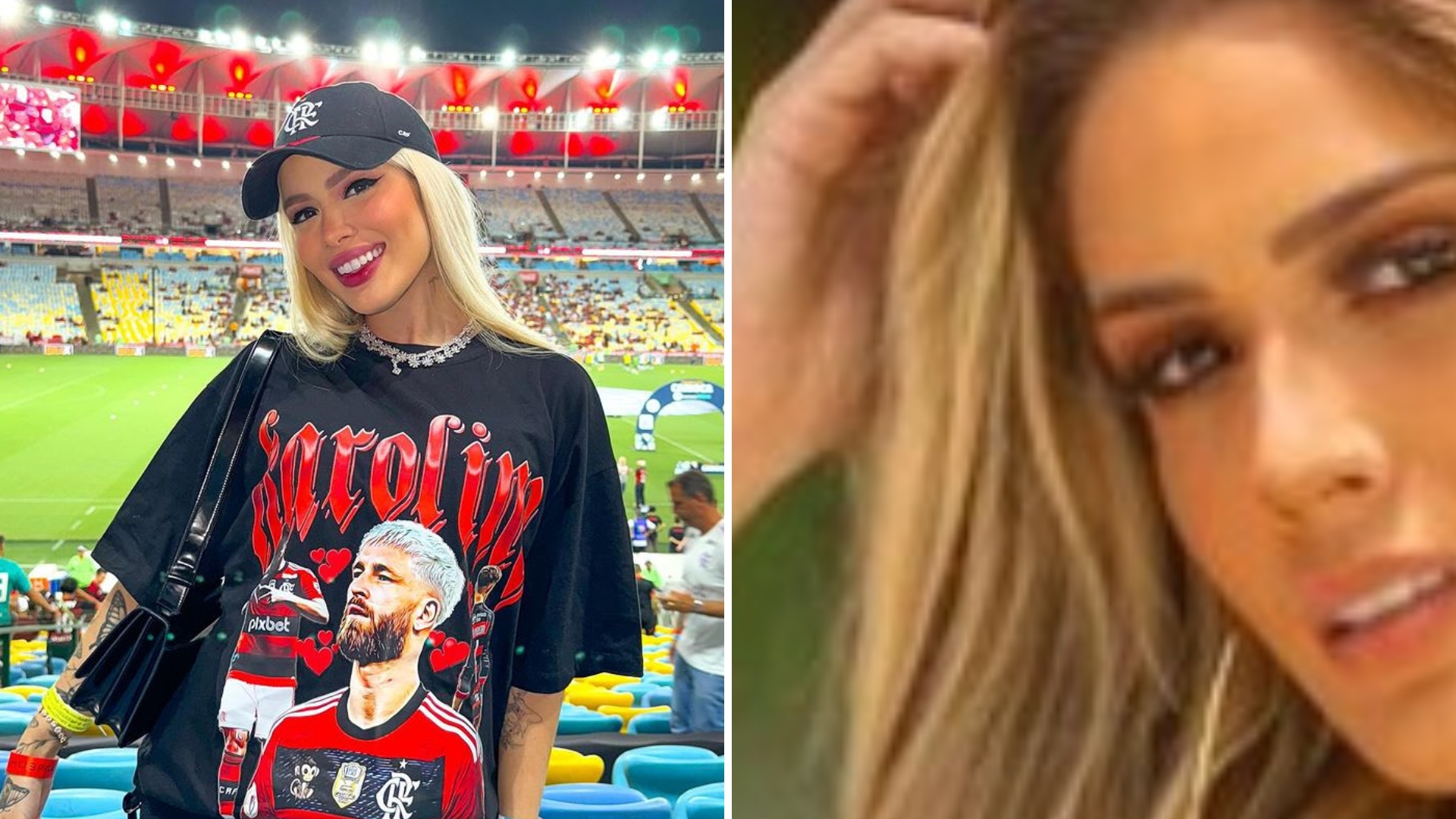 Gente! Karoline Lima impressiona ao mostrar antes e depois de procedimentos: “Skin natural”
