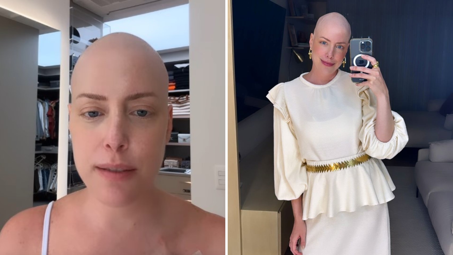 Lutando contra câncer, Fabiana Justus fala sobre a sensação de estar sem cabelo: “Doido”