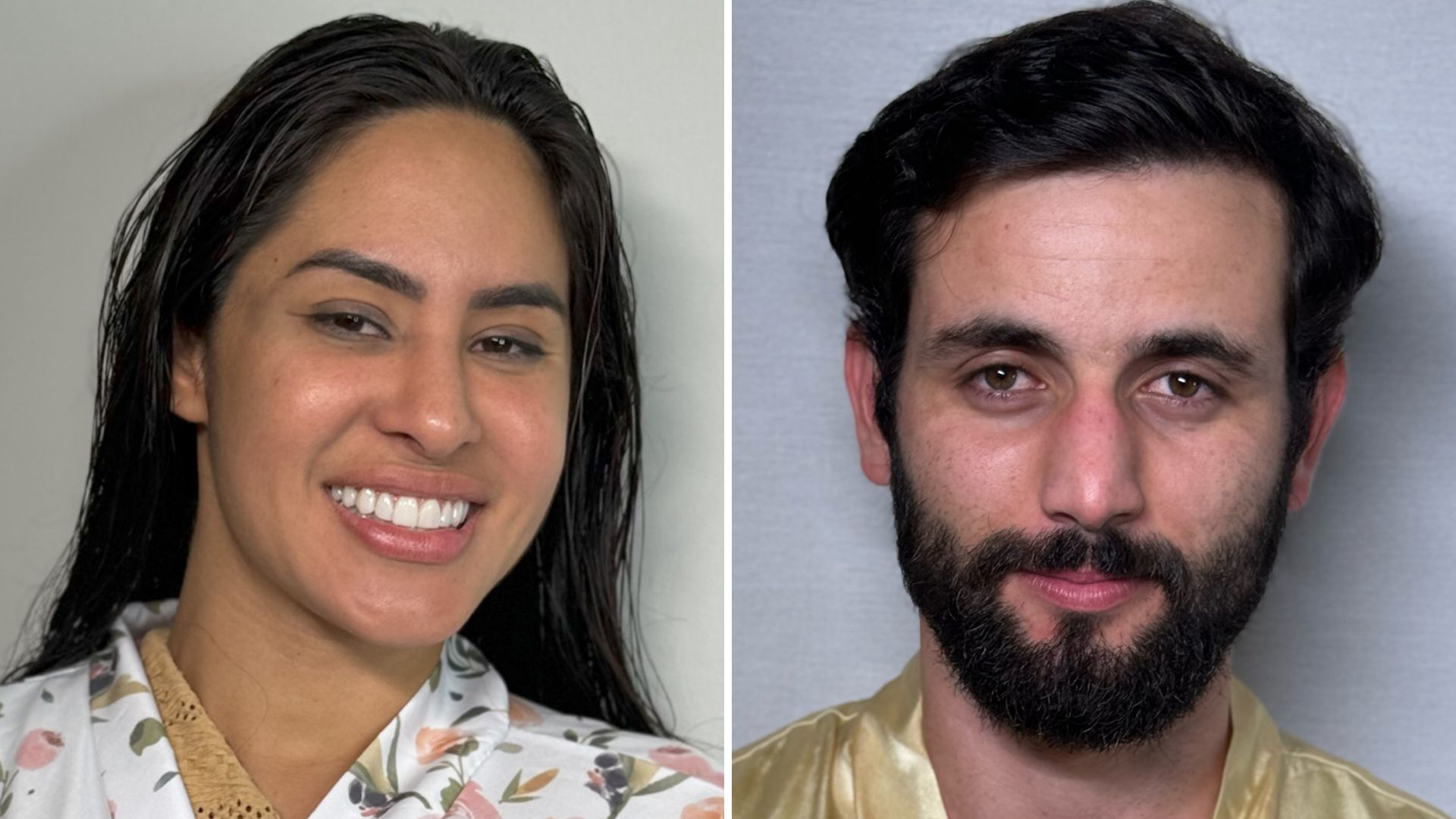 Matteus e Isabelle passam por procedimentos em pós-BBB 24; veja antes e depois