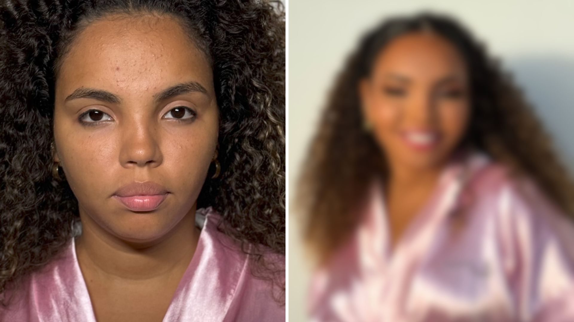 Pitel faz procedimentos estéticos após eliminação do BBB 24; veja antes e depois
