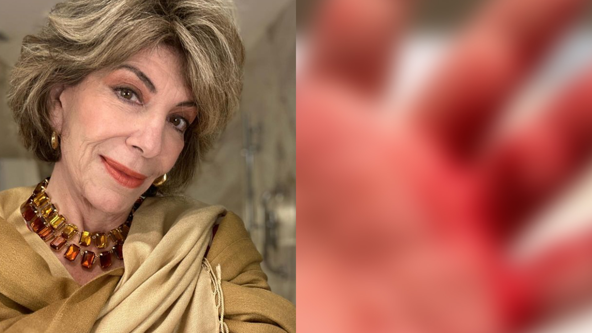 Silvia Poppovic é assaltada e ferida por criminoso: “Quase arrancaram a mão”