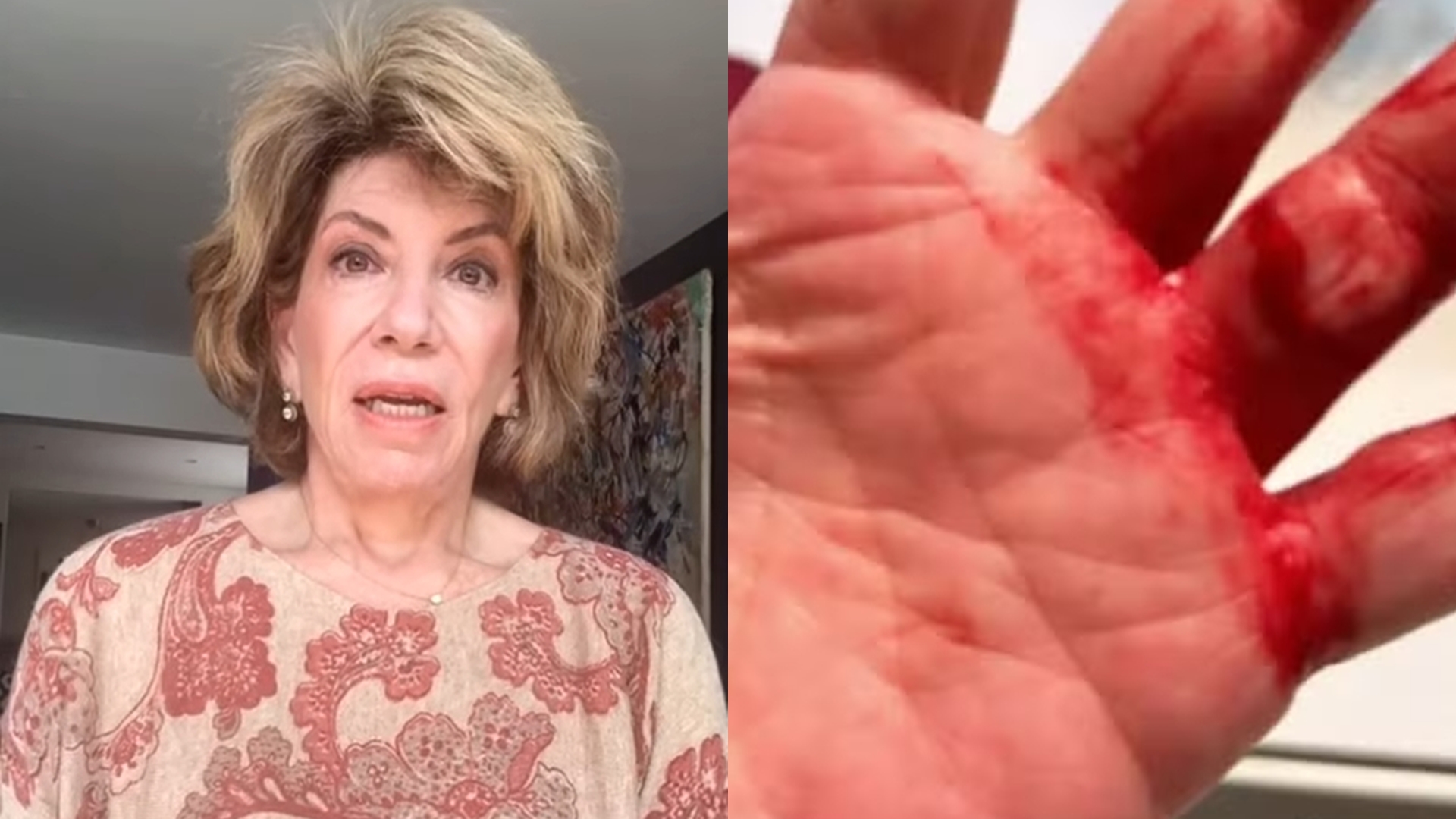 Silvia Poppovic expõe detalhes desesperadores de assalto em SP: “Me estrangulou”