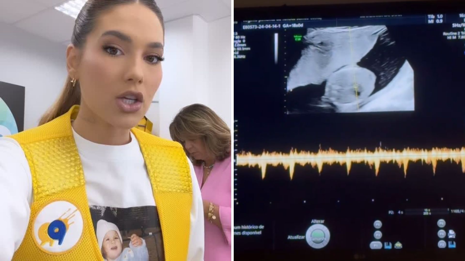 Virginia mostra ultrassom do filho após tombo no SBT: “Coraçãozinho batendo”