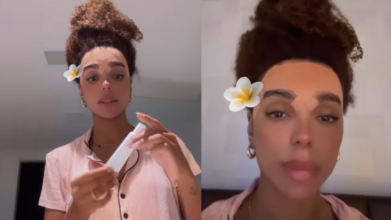 Brunna Gonçalves dá detalhes de procedimento cirúrgico no rosto: “Realizei o meu sonho”