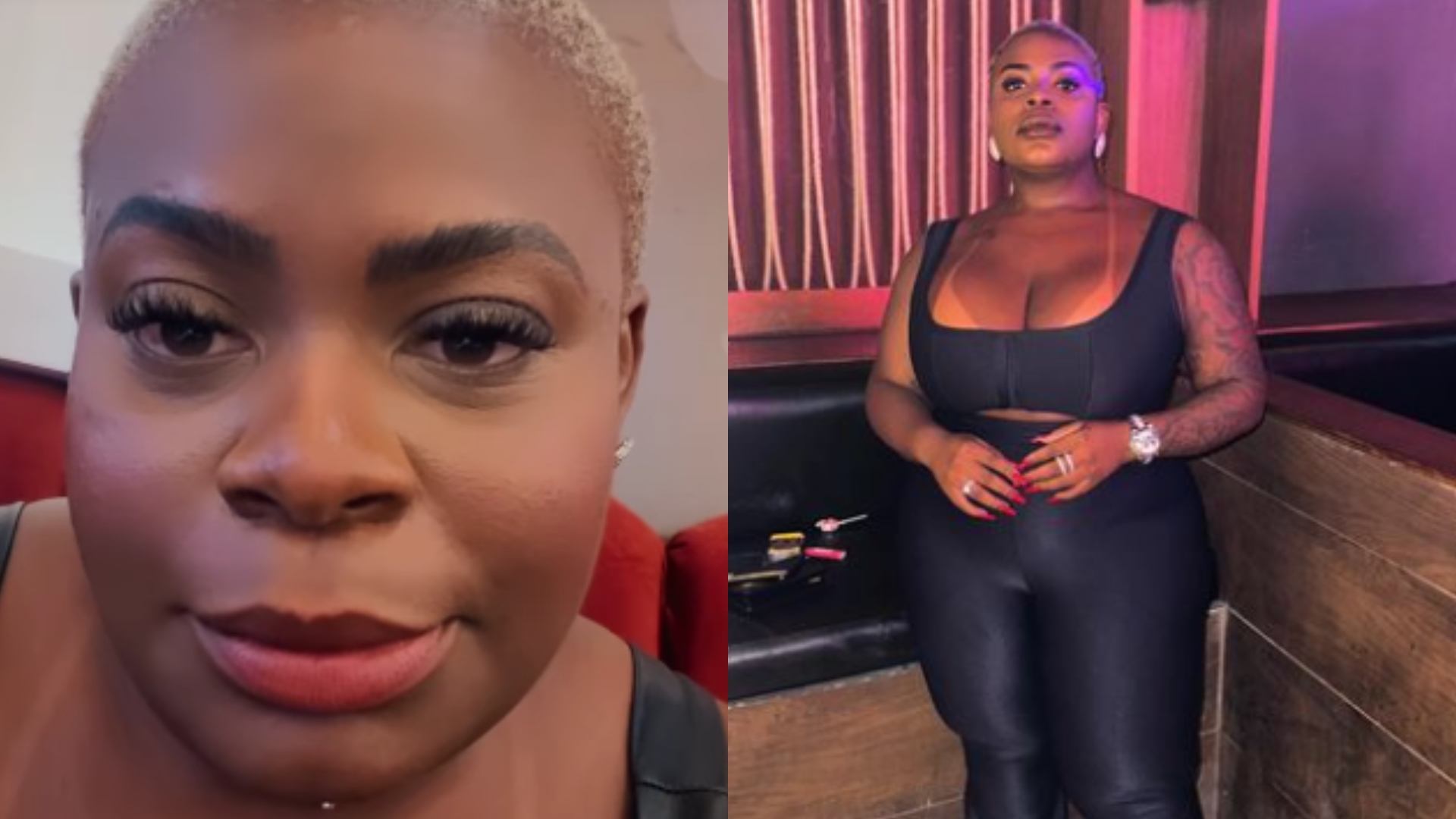 Especialista faz alerta sobre cirurgia de Jojo Todynho e analisa: “Pode interferir”