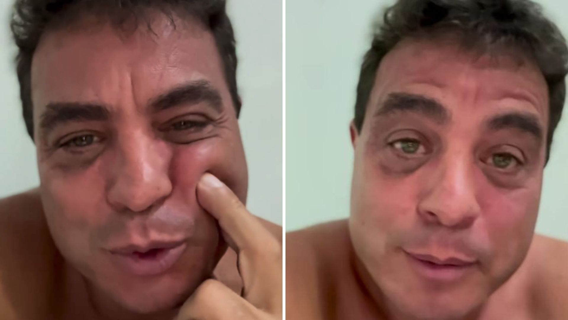 Ex-BBB Dhomini fica indignado com críticas ao seu rosto: “Envelhecer ou morrer”