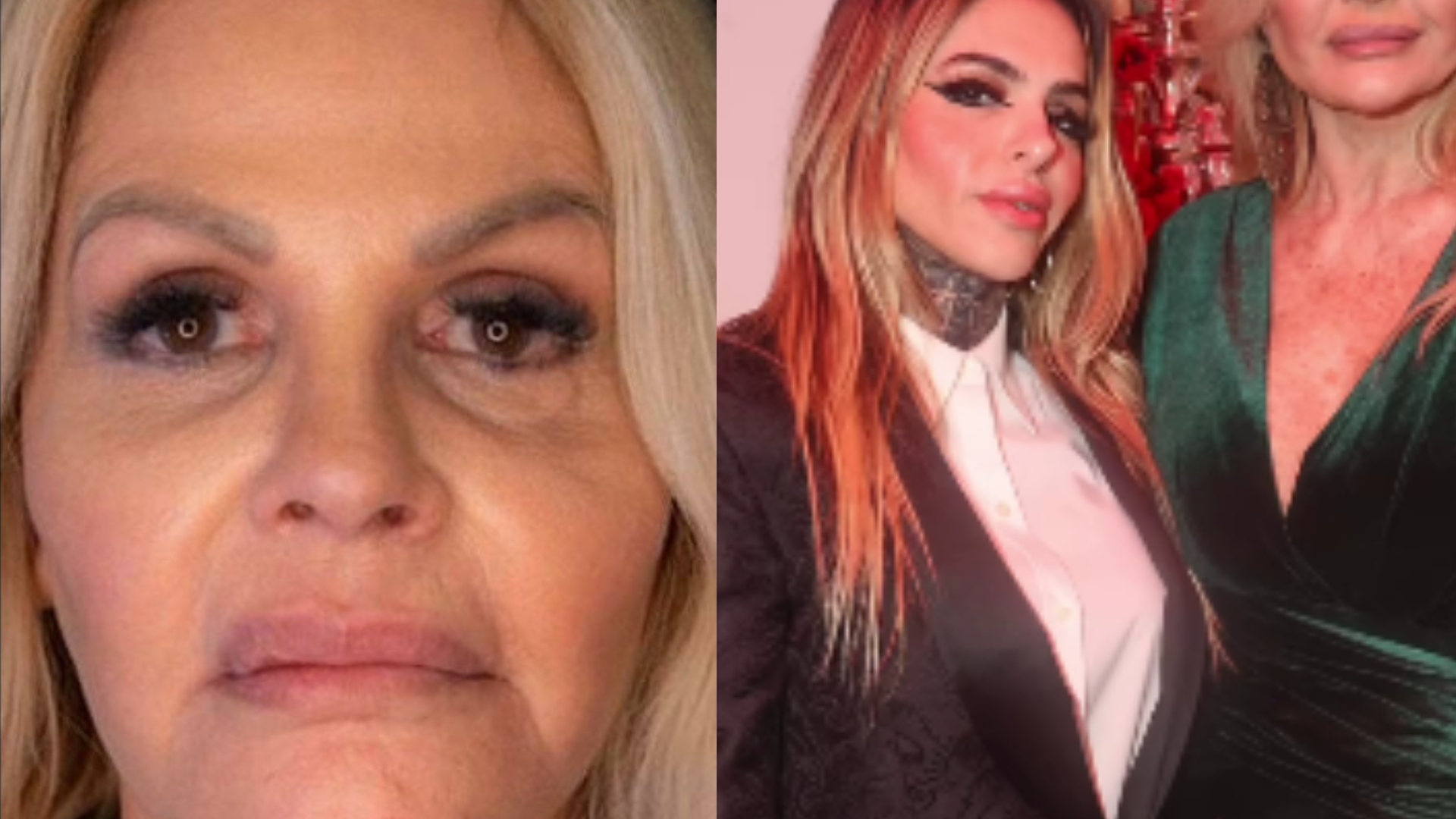 Monique Evans faz harmonização facial e resultado divide opiniões; veja antes e depois