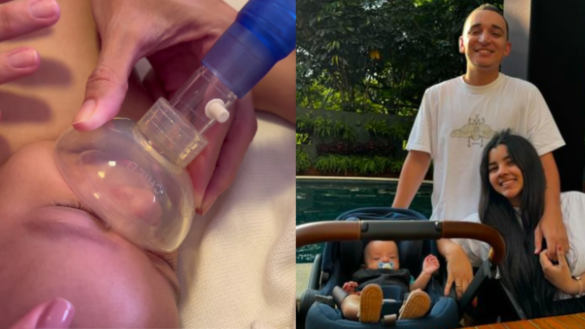 Bronquiolite: O que é e quais os sintomas da doença que afetou o filho de João Gomes?