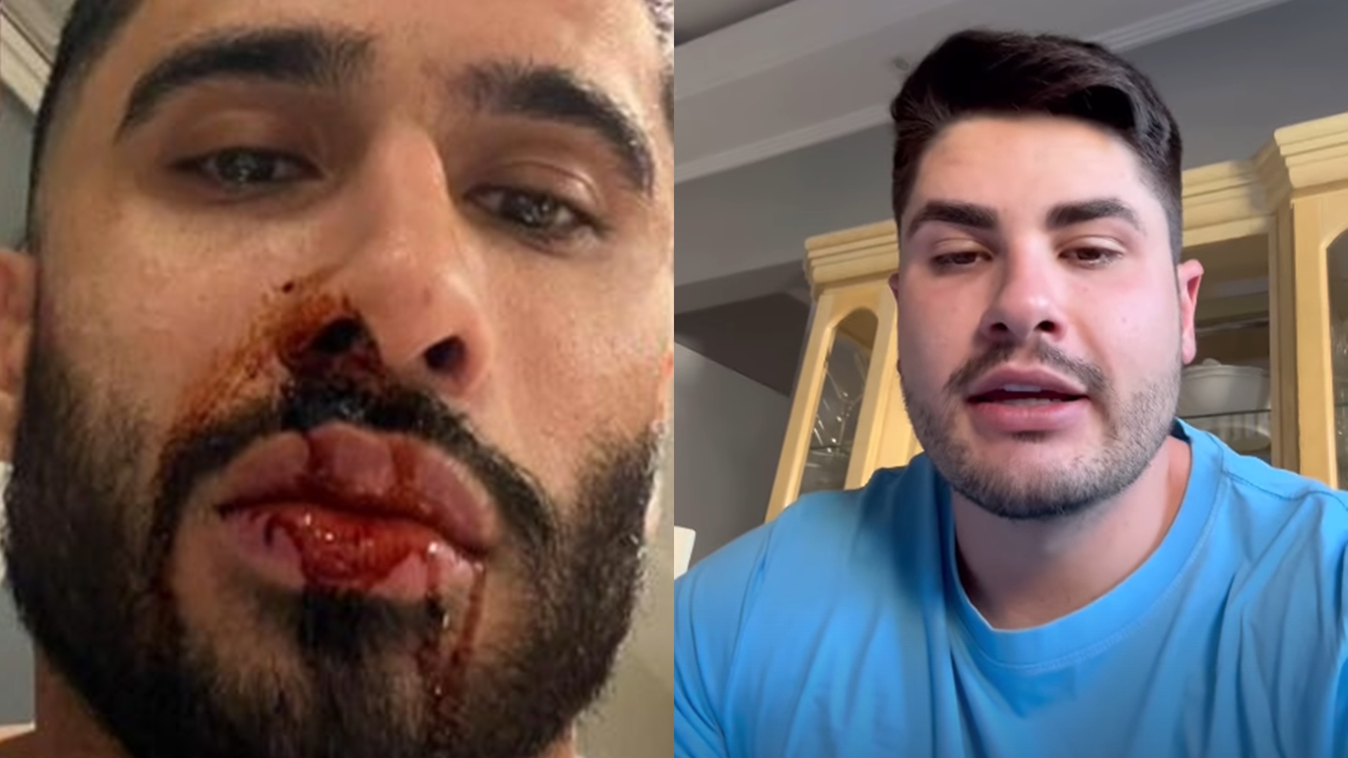 Ex de Lucas Souza expõe agressão e exibe rosto ensanguentado: “Fiz uma denúncia”