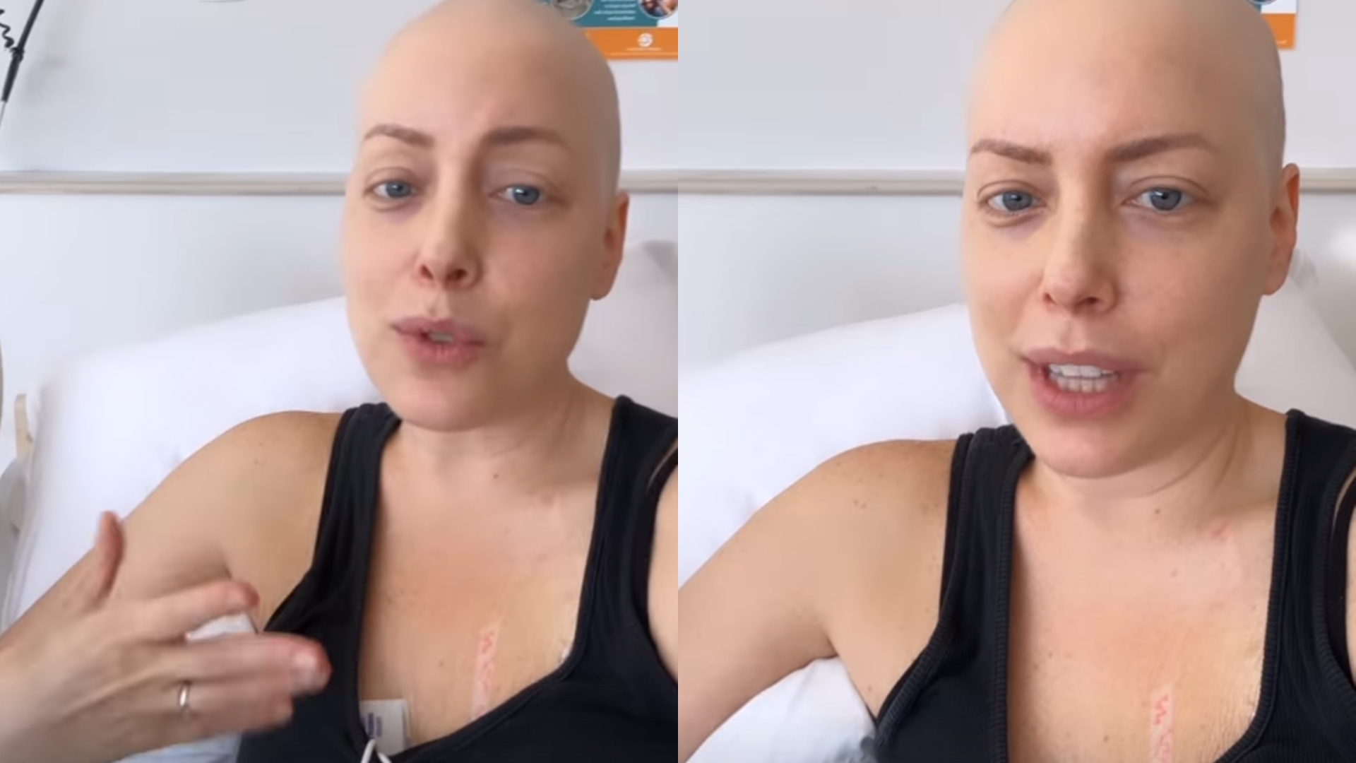 Fabiana Justus rebate seguidora sobre tratamento contra câncer: “Sempre foi difícil”