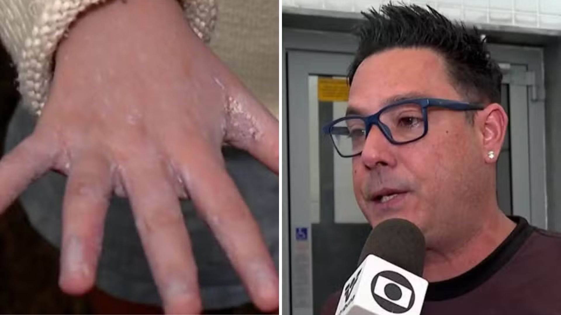 Filhos do cantor Vavá pegam sarna em escola: “Nos deixa perplexos”
