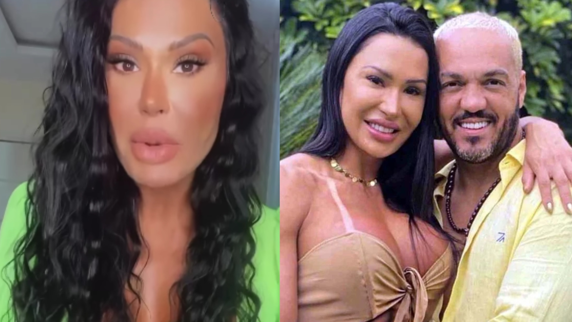Por que Gracyanne e Belo ainda moram juntos? Musa avalia reconciliação: “Quem sabe”