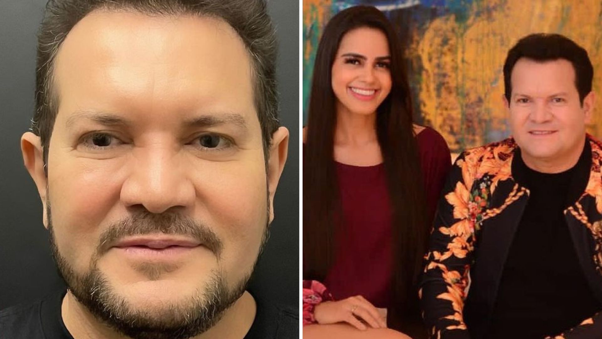 Mulher de Ximbinha reage à harmonização do marido: “Demais”