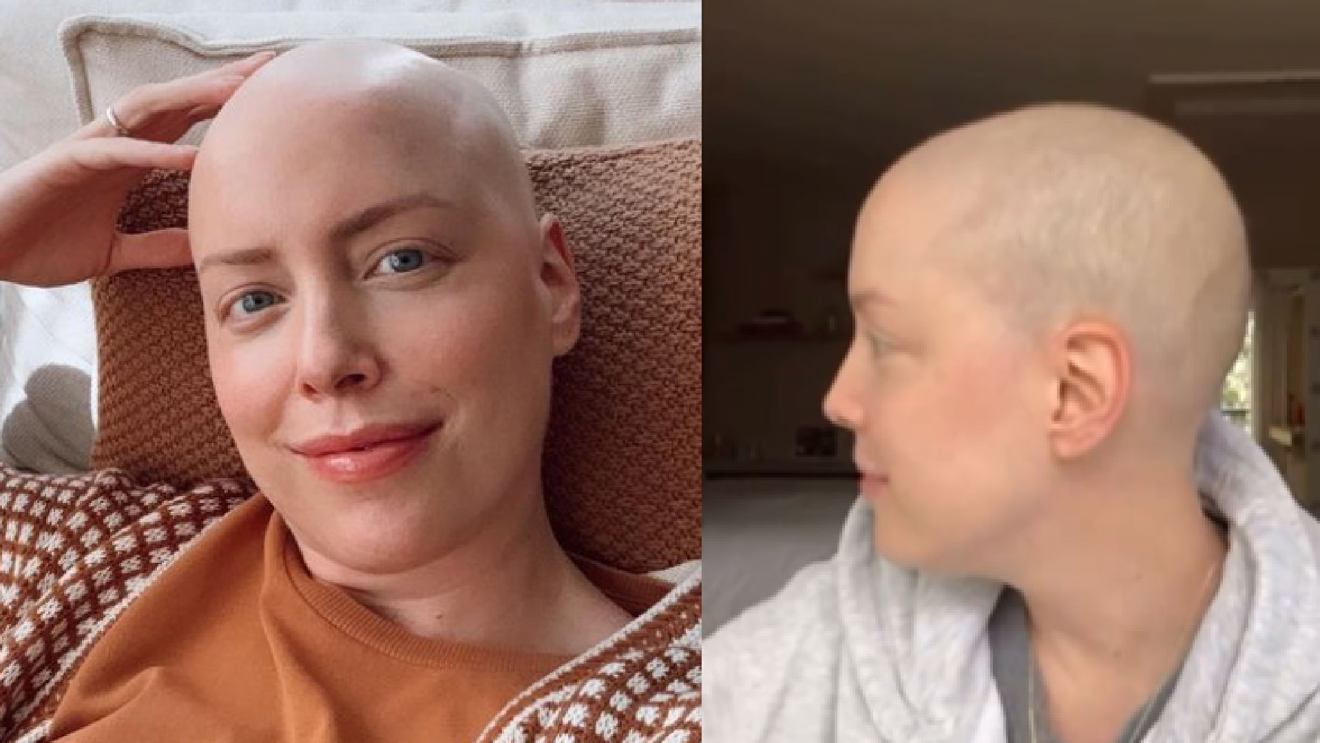 Após quimioterapia, Fabiana Justus celebra crescimento do cabelo: “Nascendo”