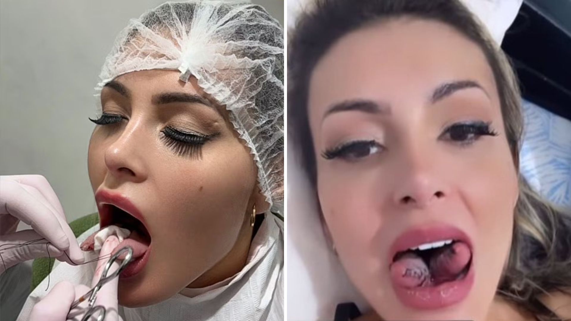 Andressa Urach pode enfrentar problema sério após bifurcação: “Casos fatais”