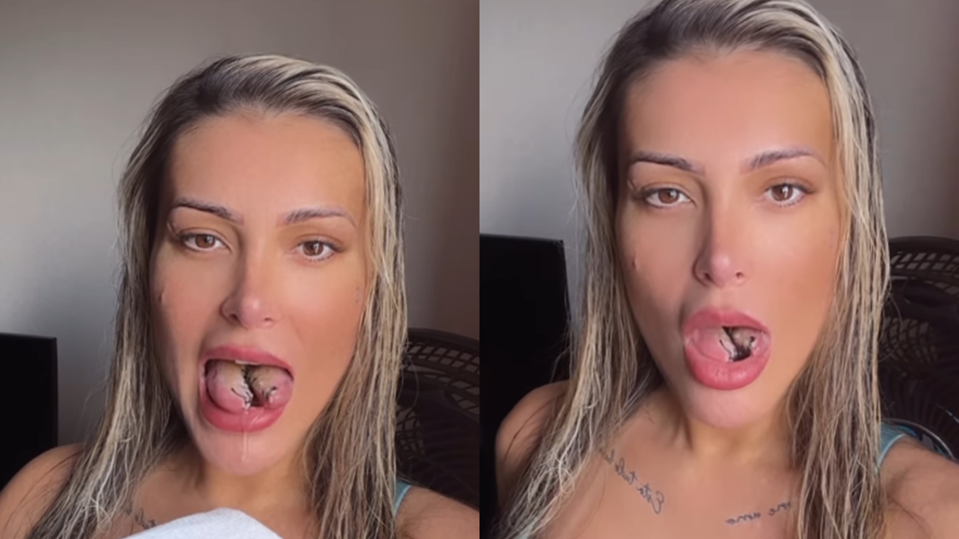 Andressa Urach sofre problema após cirurgia na língua: “Não está conseguindo falar”