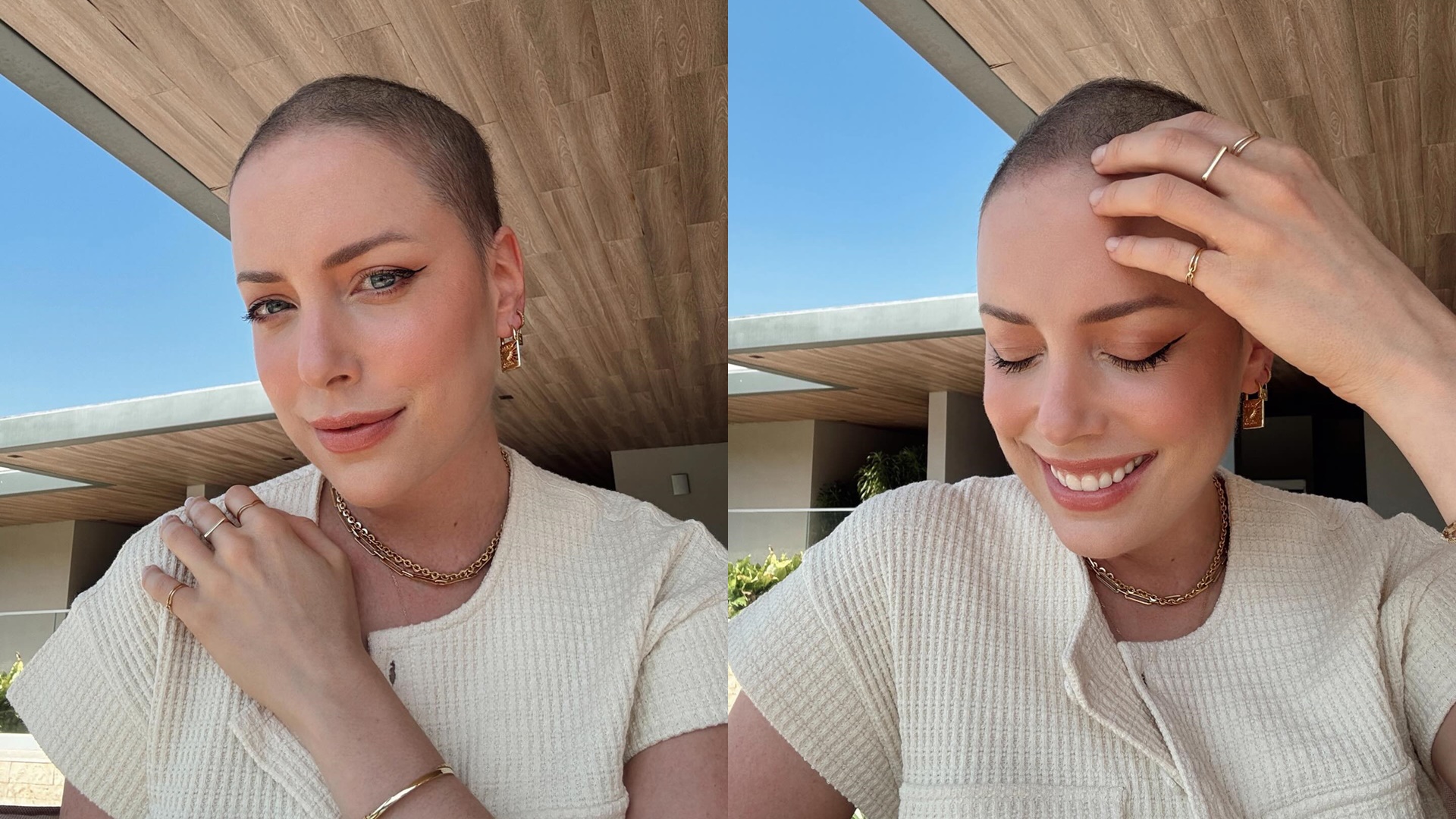 Fabiana Justus comemora crescimento do cabelo após luta contra câncer: “Me enxergar”